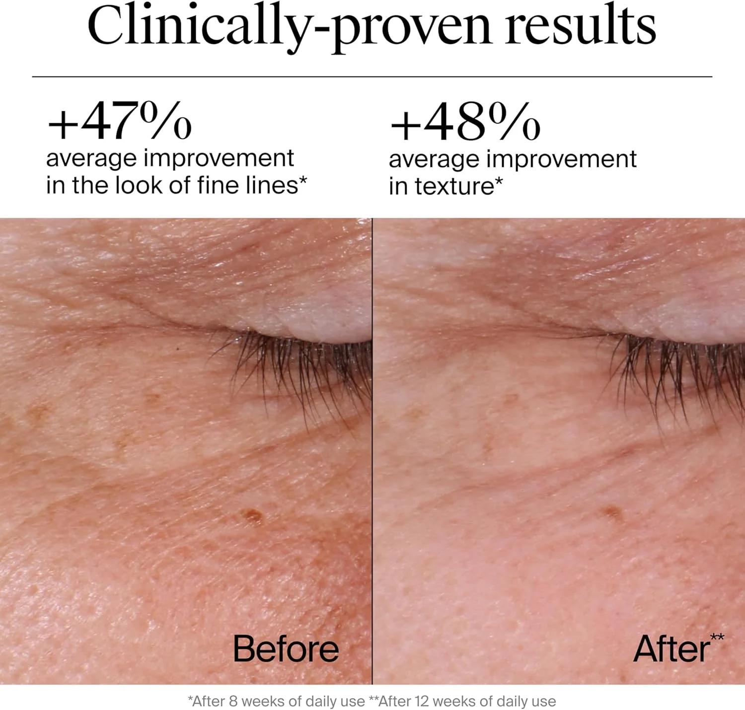 کرم مرطوب کننده صورت نوتروژینا رتینول، ترمیم کننده سریع چروک، بدون عطر، کرم ضد پیری روزانه صورت با رتینول و اسید هیالورونیک برای مبارزه با خطوط ریز، چروک ها و لکه های تیره، 50 میلی لیتر کرم مرطوب کننده صورت نوتروژینا رتینول، ترمیم کننده سریع چروک، بدون عطر، کرم ضد پیری روزانه صورت با رتینول و اسید هیالورونیک برای مبارزه با خطوط ریز، چروک ها و لکه های تیره، 50 میلی لیتر