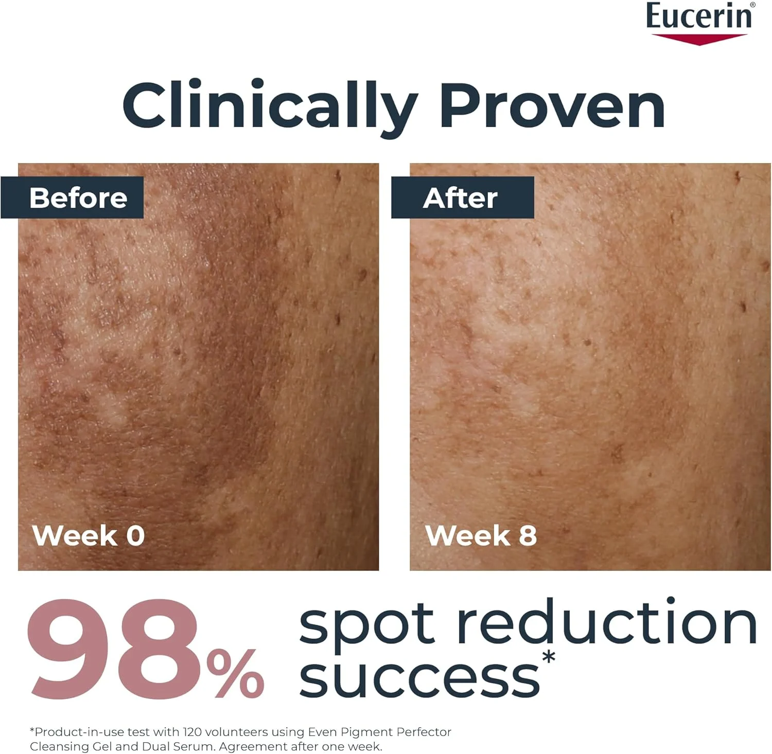 کرم شب صورت اوسرین Even Pigment Perfector حاوی تیامیدول، کاهش لکههای تیره و بازسازی پوست، جذب سریع، مرطوب کننده برای انواع پوست، 50 میلی لیتر کرم شب صورت اوسرین Even Pigment Perfector حاوی تیامیدول، کاهش لکههای تیره و بازسازی پوست، جذب سریع، مرطوب کننده برای انواع پوست، 50 میلی لیتر