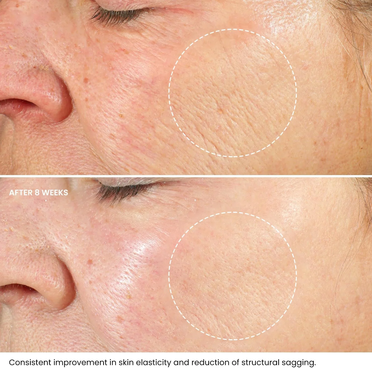 کرم صورت و گردن ضد چروک خالص رتینول با اسید هیالورونیک - مرطوب کننده صورت ضد پیری ممتاز - کرم صورت سفت کننده ضد پیری برای کاهش چین و چروک، لکه های تیره، خطوط ریز، آسیب های ناشی از آفتاب - 50 میلی لیتر