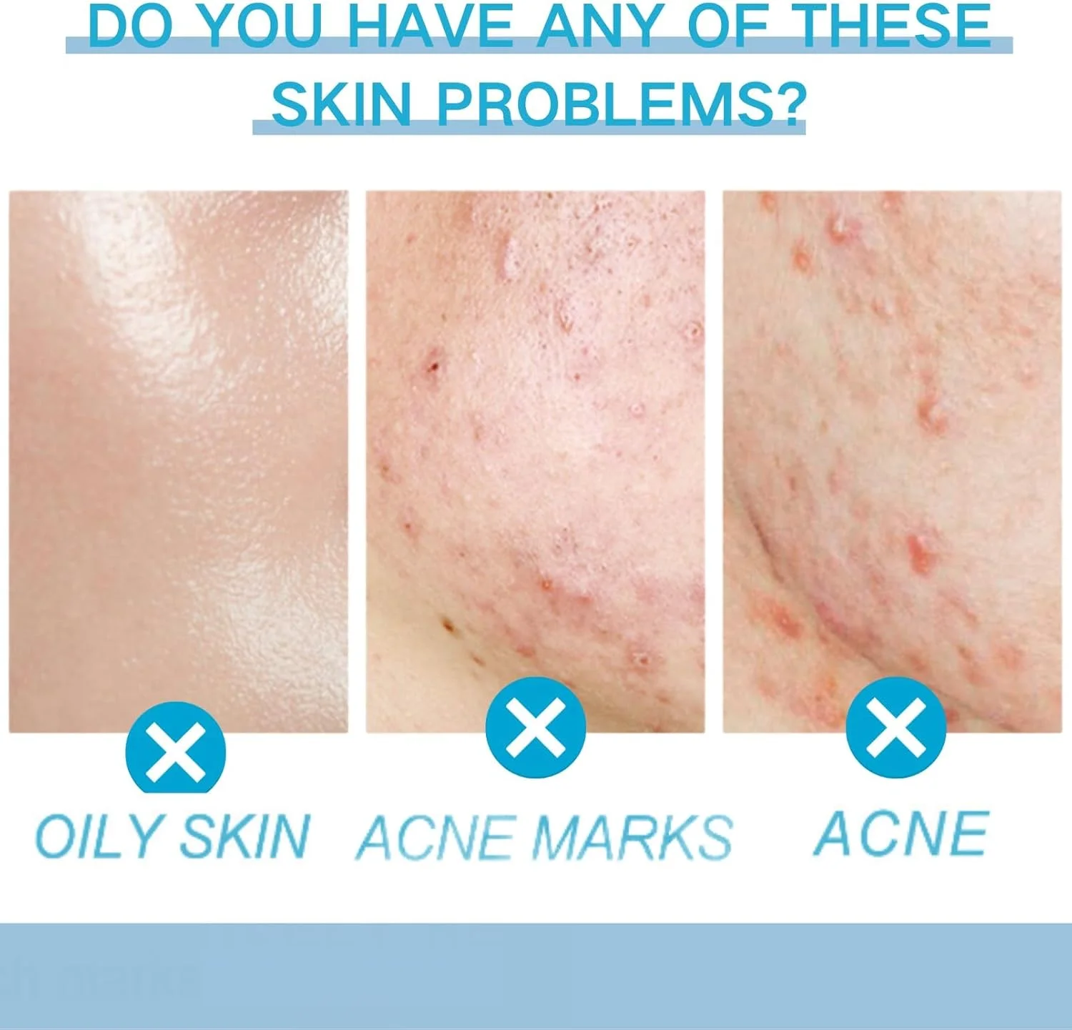 کرم اسید سالیسیلیک برای پوست مستعد جوش، ژل درمان جوش، از بین برنده لک های تیره صورت، مناسب برای جوش های فعال، متعادل کننده چربی، سفت کننده منافذ، محو کننده جای جوش، کنترل و رفع آکنه کرم اسید سالیسیلیک برای پوست مستعد جوش، ژل درمان جوش، از بین برنده لک های تیره صورت، مناسب برای جوش های فعال، متعادل کننده چربی، سفت کننده منافذ، محو کننده جای جوش، کنترل و رفع آکنه