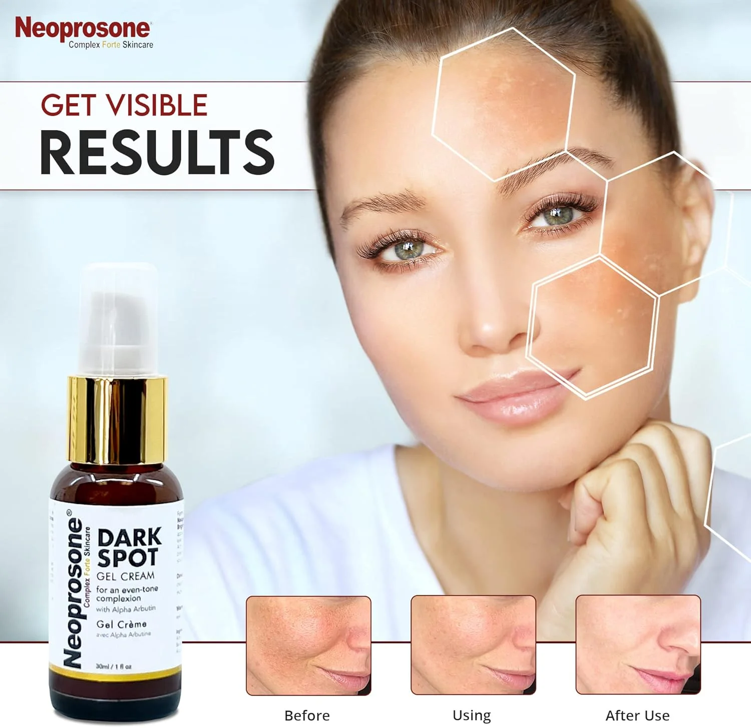 ژل کرم از بین برنده لکههای تیره نئوپروزون - 30 میلی لیتر - ژل کرم صورت، کاهش آکنه، لکههای ناشی از آفتاب، لکههای پیری روی صورت، زانوها، آرنجها، دستها، نواحی خصوصی ژل کرم از بین برنده لکههای تیره نئوپروزون - 30 میلی لیتر - ژل کرم صورت، کاهش آکنه، لکههای ناشی از آفتاب، لکههای پیری روی صورت، زانوها، آرنجها، دستها، نواحی خصوصی