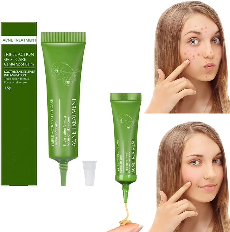 کرم ضد جوش آزونه با عصاره سنتلا، درمان موضعی جوش، کوچک کننده منافذ و ترمیم کننده جای زخم، کنترل کننده چربی، تسکین دهنده قرمزی، فرمول ضد باکتری برای پوستی شفاف تر (15 گرم)