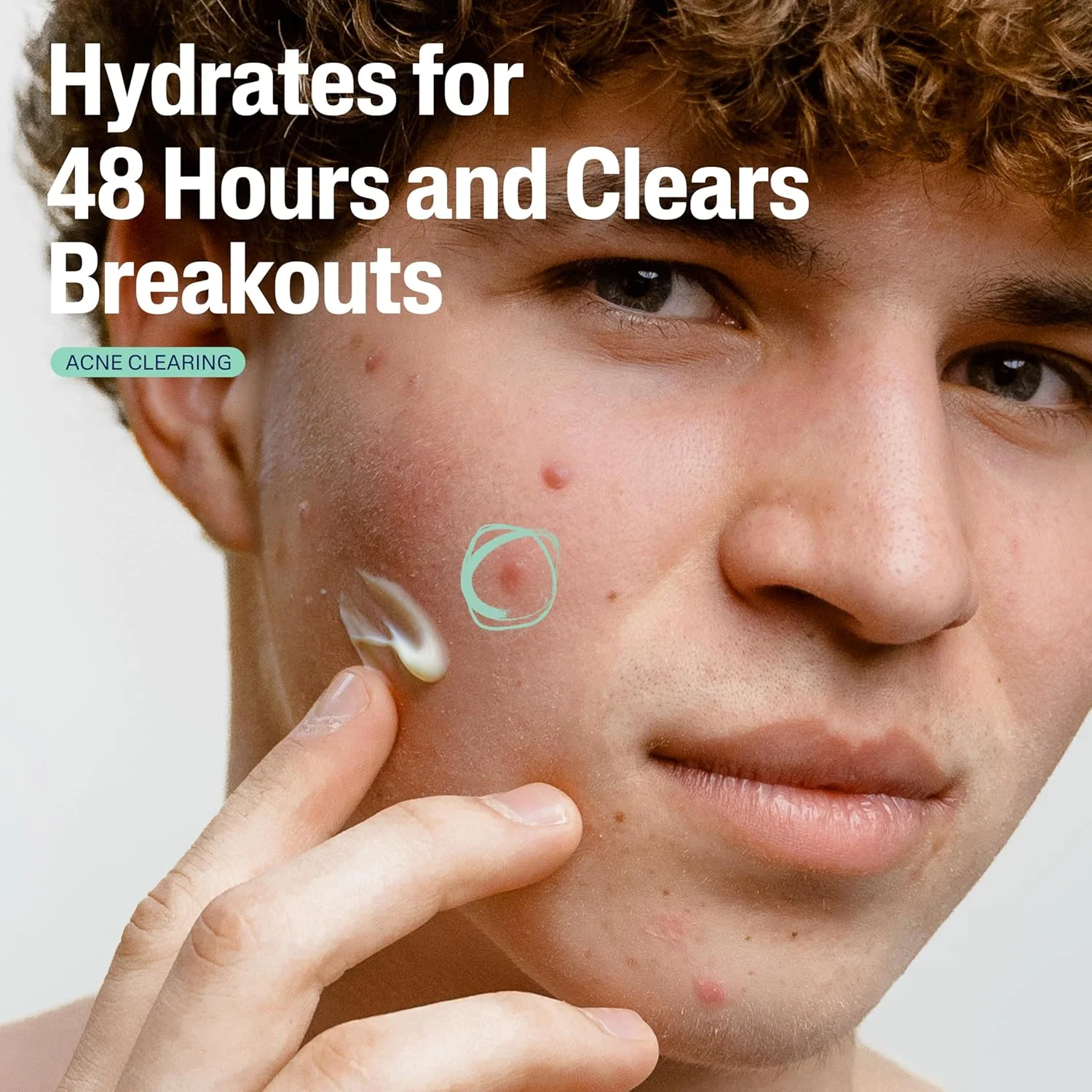 مرطوب کننده صورت ستافیل، مرطوب کننده ملایم و مات کننده پوست مستعد جوش با 0.5% سالیسیلیک اسید، آبرسان و درمان کننده پوست حساس و مستعد آکنه، مراقبت از پوست حساس، 85 گرم مرطوب کننده صورت ستافیل، مرطوب کننده ملایم و مات کننده پوست مستعد جوش با 0.5% سالیسیلیک اسید، آبرسان و درمان کننده پوست حساس و مستعد آکنه، مراقبت از پوست حساس، 85 گرم