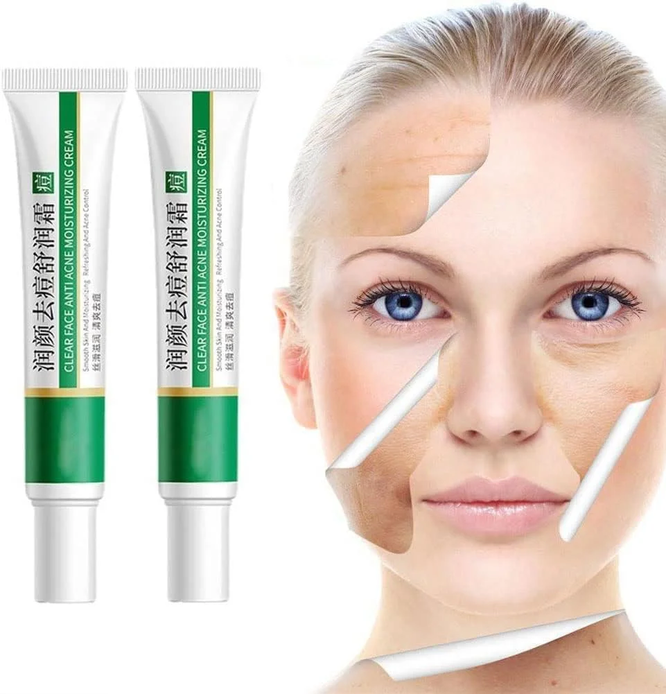 کرم روشن کننده و ضد لک، کرم درمان از بین بردن جای زخم، کرم از بین بردن رنگدانه های صورت، کرم از بین برنده لک، کرم مرطوب کننده ضد لک، روشن کننده پوست و از بین برنده لکه های تیره (کرم جای زخم)