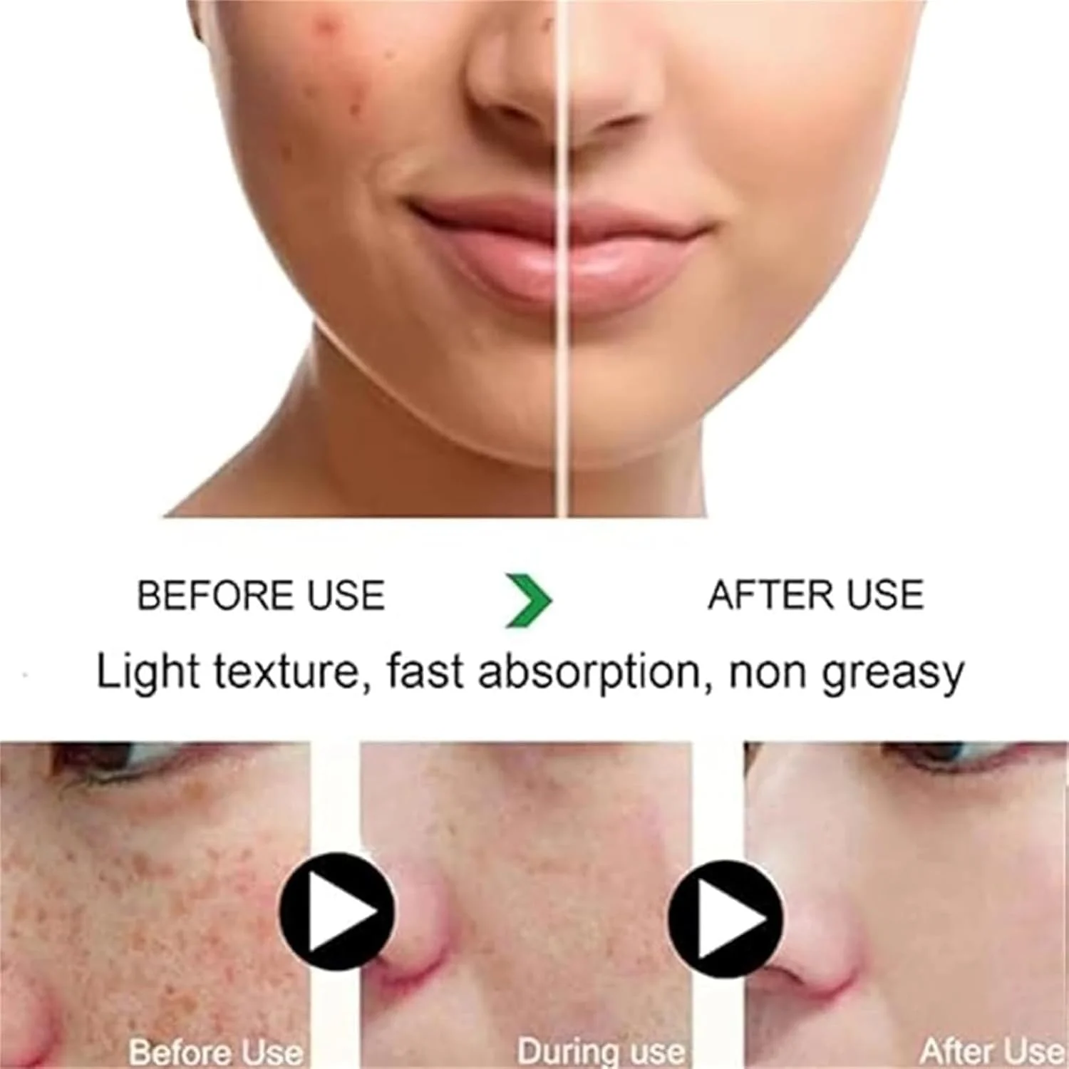 کرم روشن کننده و ضد لک Aimierbuy، درمان هایپرپیگمنتیشن صورت، روشن کننده و مرطوب کننده، کاهش تیرگی و لک، یکدست کننده رنگ پوست (2 عدد)