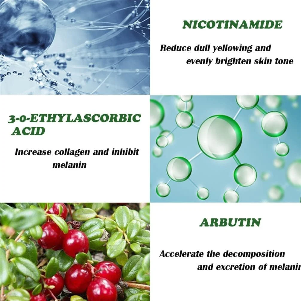 کرم رفع لکه‌های سفید دکتر هنسی، کرم روشن کننده و رفع کک و مک، کرم رفع ملاسما، رفع لکه‌های تیره صورت، درمان هایپرپیگمنتیشن، کرم مرطوب کننده و صاف کننده پوست صورت مناسب برای انواع پوست (50 گرم)