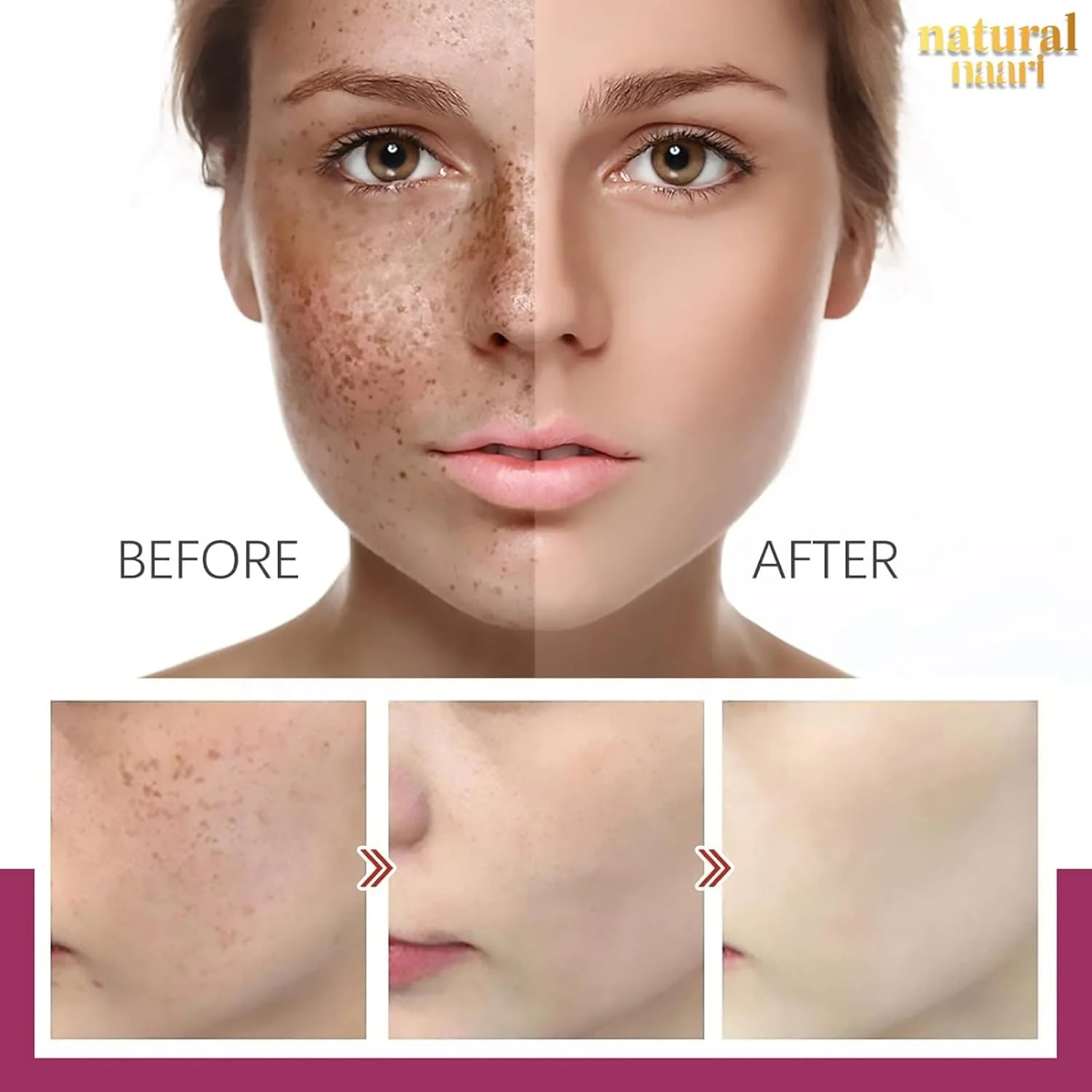 کرم اصلاح کننده رنگدانه صورت - روشن کننده طبیعی پوست و رفع لک های تیره - 50 گرم - کرم ضد لک برای یکنواخت کردن رنگ پوست - استفاده روزانه برای انواع پوست