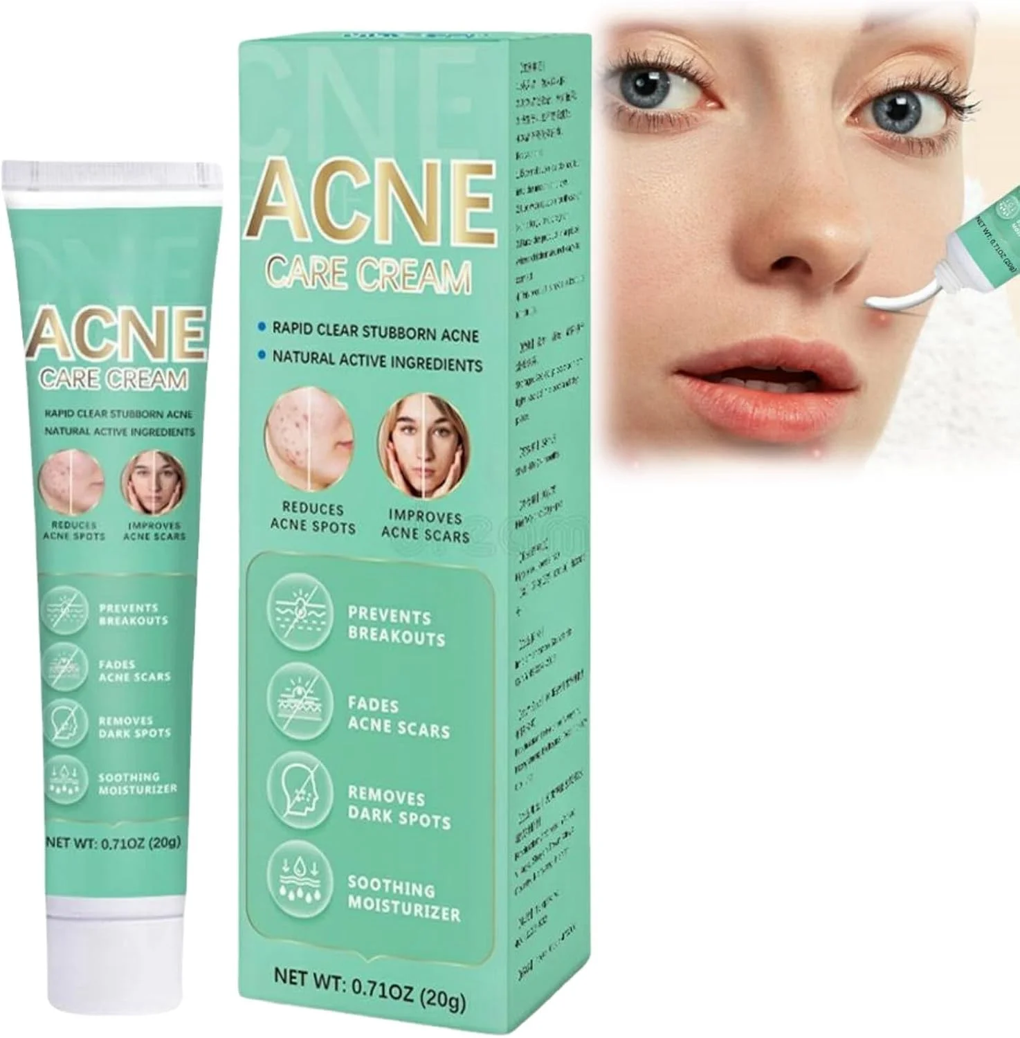 کرم صورت ضد جوش FUIN، کرم درمان موضعی جوش، کرم جوش برای درمان جوش و درمان موضعی، کرم کنترل چربی پوست، کرم ژل درمان جوش برای لک ها، جوش های سرسیاه، پوست مستعد آکنه