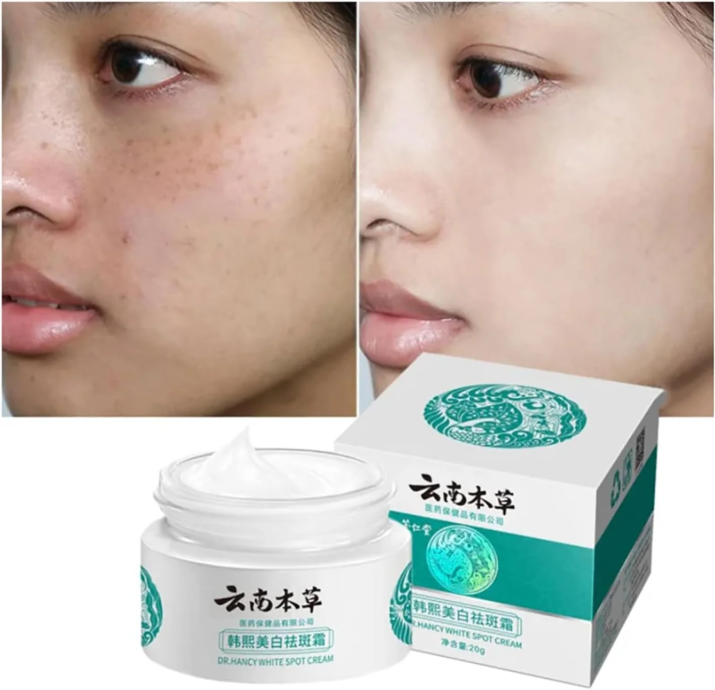 کرم ملاسما ژاپنی TurhAn اصل، کرم لک سفید دکتر هنسی، کرم ملاسما ژاپنی، هنسی یوننان، برای مرطوب کردن صورت و رفع لک ها، مناسب برای انواع پوست (5 عدد)