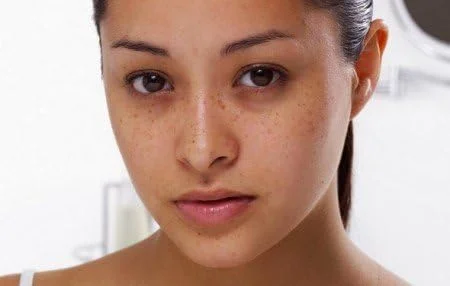 کرم ضد لک قوی ولتافاس ACM DEPIWHITE ADVANCED حجم 40 میلی لیتر (طراحی بسته بندی ممکن است متفاوت باشد) کرم ضد لک قوی ولتافاس ACM DEPIWHITE ADVANCED حجم 40 میلی لیتر (طراحی بسته بندی ممکن است متفاوت باشد)