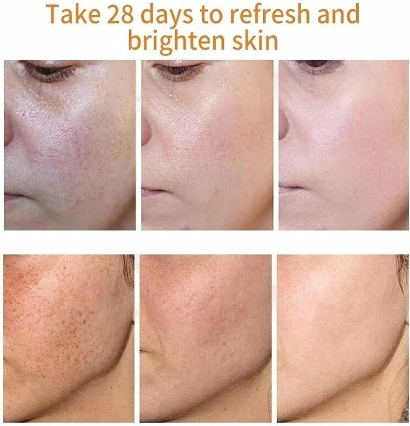 کرم روشن کننده و ضد لک، کرم درمان جای جوش، کرم رفع رنگدانه های صورت، مرطوب کننده ضد چروک و ضد لک، موثر در رفع ملاسما و لکه های تیره (2 عدد)