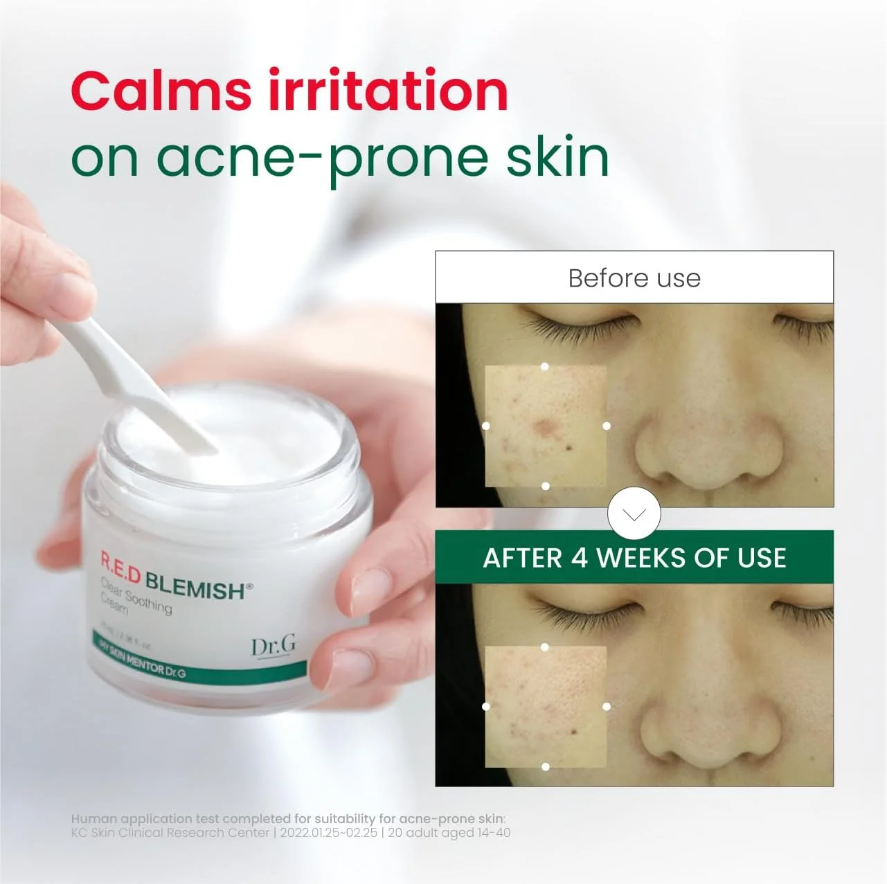 کرم تسکین دهنده و شفاف کننده پوست دکتر جی مدل NEW RED Blemish (۷۰ میلی لیتر) گوهونسسانگ کازمتیک، کرم ترمیم کننده و مرطوب کننده