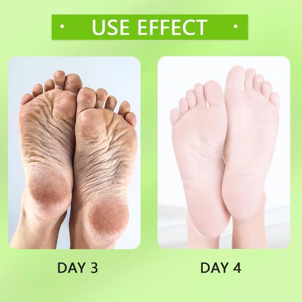 بسته های خیساندن پا ژله ای برای پدیکور، نمک های خیساندن پا برای پدیکور، بسته 5 عددی چندگانه لایه بردار اسپا پا شامل شیر، نعناع و موارد دیگر برای پاهای خسته، ژل رفع بوی پا برای مراقبت از پدیکور اسپا پا بسته های خیساندن پا ژله ای برای پدیکور، نمک های خیساندن پا برای پدیکور، بسته 5 عددی چندگانه لایه بردار اسپا پا شامل شیر، نعناع و موارد دیگر برای پاهای خسته، ژل رفع بوی پا برای مراقبت از پدیکور اسپا پا