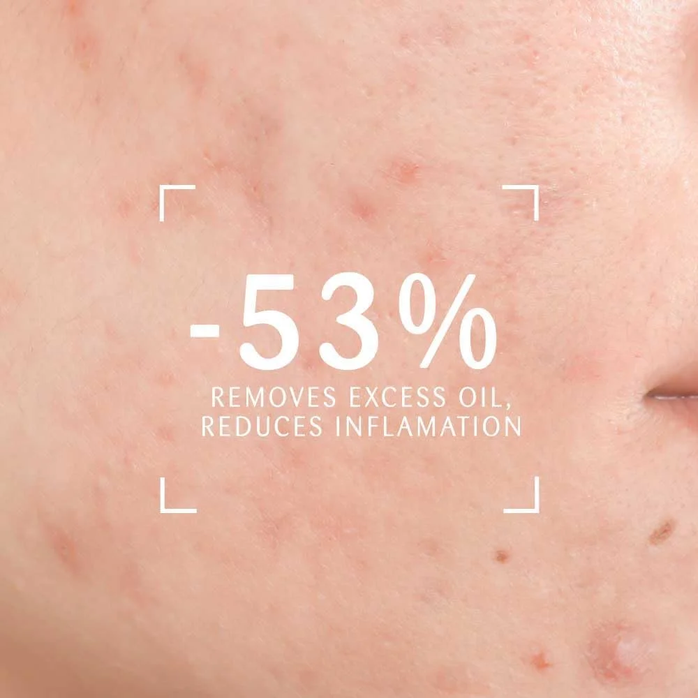 ژل شستشوی فومینگ شفاف کننده پوست چرب و مختلط - بدون سولفات، متعادل کننده pH، کنترل چربی، تست شده توسط متخصص پوست - 200 میلی لیتر