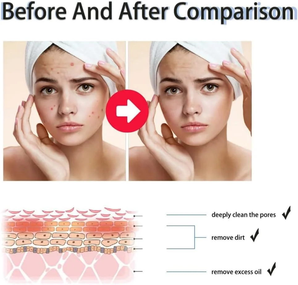 مجموعه لایه بردار مایع و ژل BHA 2% آزونی، سرم شفاف کننده لایه بردار صورت، سرم آبرسان محو کننده ، لایه بردار مرطوب کننده پوست و تونر BHA برای بانوان، 50 میلی لیتر