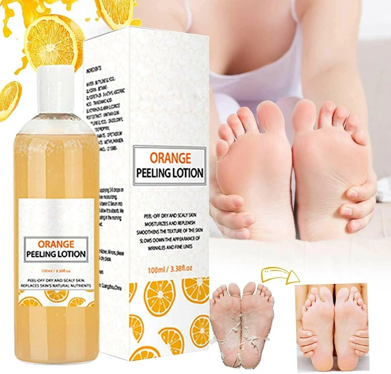 ژل لایه بردار پوست پرتقال، رفع تیرگی، مرطوب کننده و روشن کننده پوست، محو کننده ملانین، مناسب برای گردن، زانو، آرنج، زیر بغل، 100 میلی لیتر (2 عدد)
