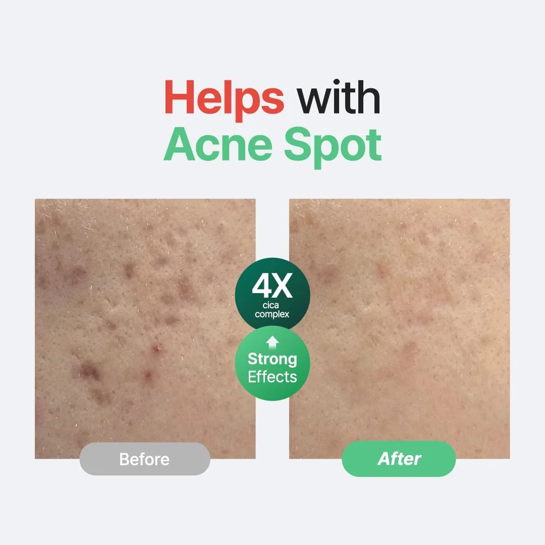 سرم بدون عطر سنتلا پوریتو، سنتلا کره ای، مناسب برای انواع پوست، آمپول، تسکین دهنده، آرامش بخش، سرم صورت، وگان و بدون تست حیوانی، مراقبت از پوست کره ای، 60 میلی لیتر