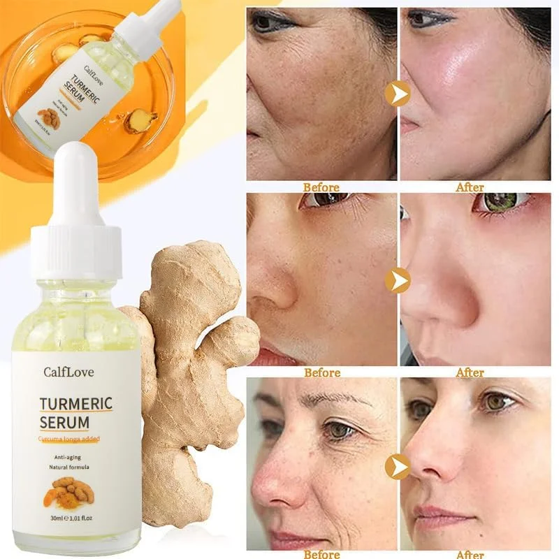 روغن صورت زردچوبه برای مرطوب‌سازی و روشن‌کنندگی پوست، کمک به کاهش لکه‌های تیره، آکنه و هایپرپیگمنتیشن، سرم مغذی زردچوبه برای ظاهری صاف و یکدست