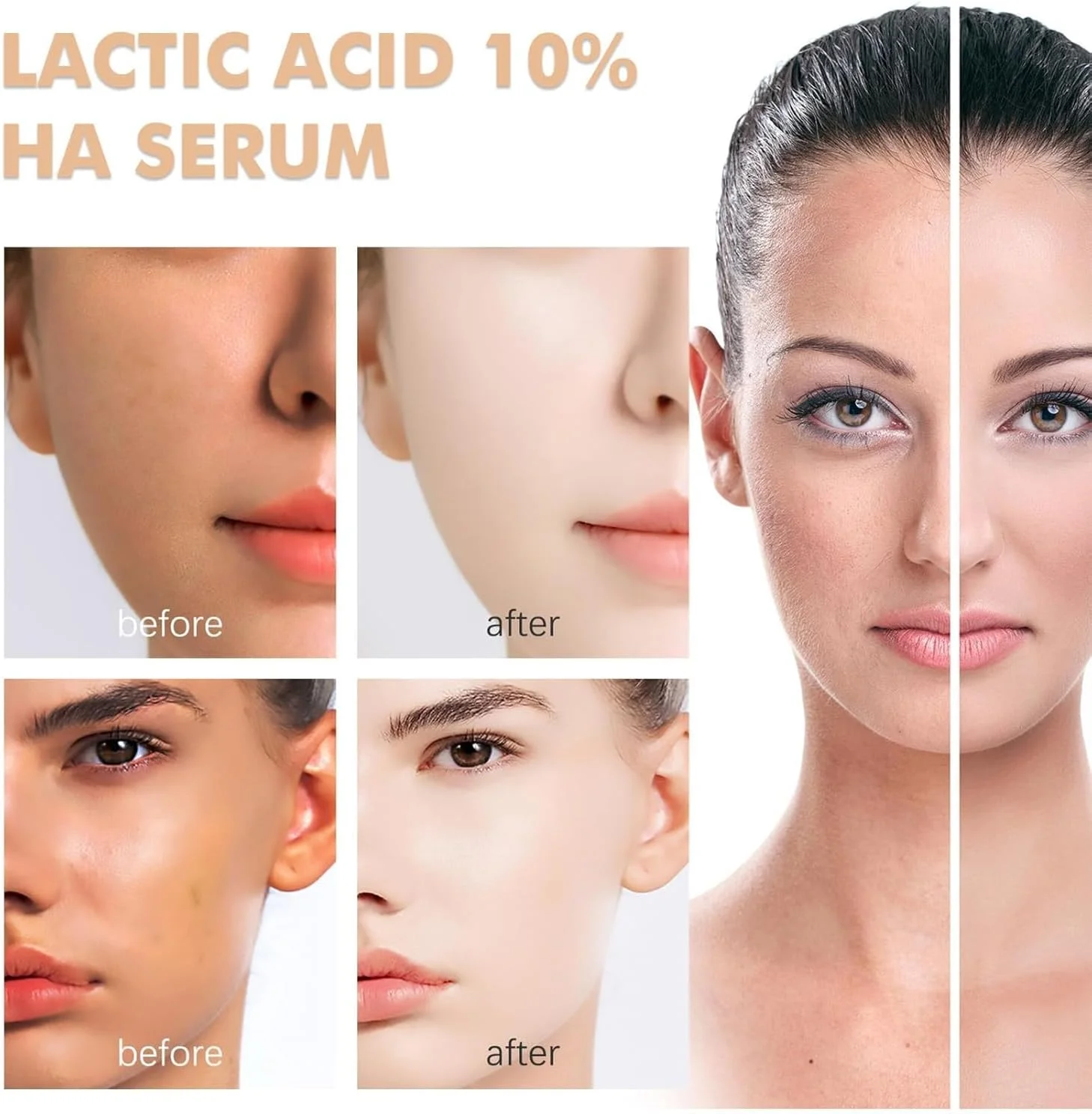 سرم اسید لاکتیک زنانه 30 میلی لیتر، سرم صورت 5% اسید لاکتیک و اسید هیالورونیک، فرمول مرطوب کننده و لایه بردار برای پوست خشک، بافت پوست را صاف می کند، آبرسانی می کند و درخشندگی پوست را افزایش می دهد