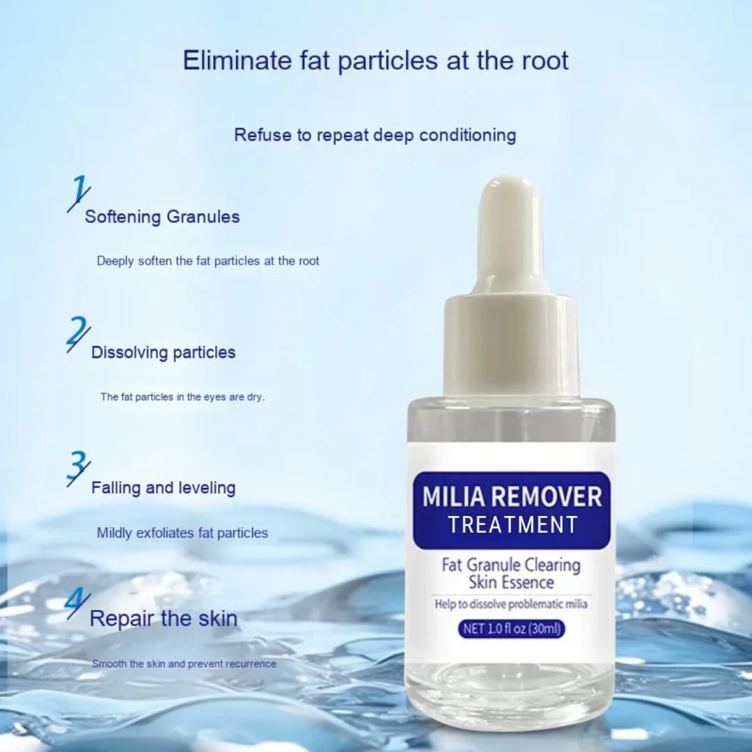 سرم از بین برنده دانه های چربی نیکیتا ویوی 30 میلی لیتر، درمان میلیوم، مایع ملایم و مرطوب کننده برای از بین بردن دانه های چربی و پوست صاف