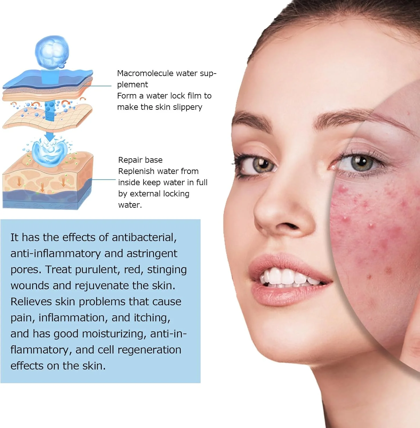 سرم هیالورونیک اسید صورت، کلاژن مرطوب کننده، برای آبرسانی، مراقبت از صورت ضد چروک، کاهش چین و چروک، محو کردن آکنه، روشن کننده، آبرسان و اسانس مرطوب کننده