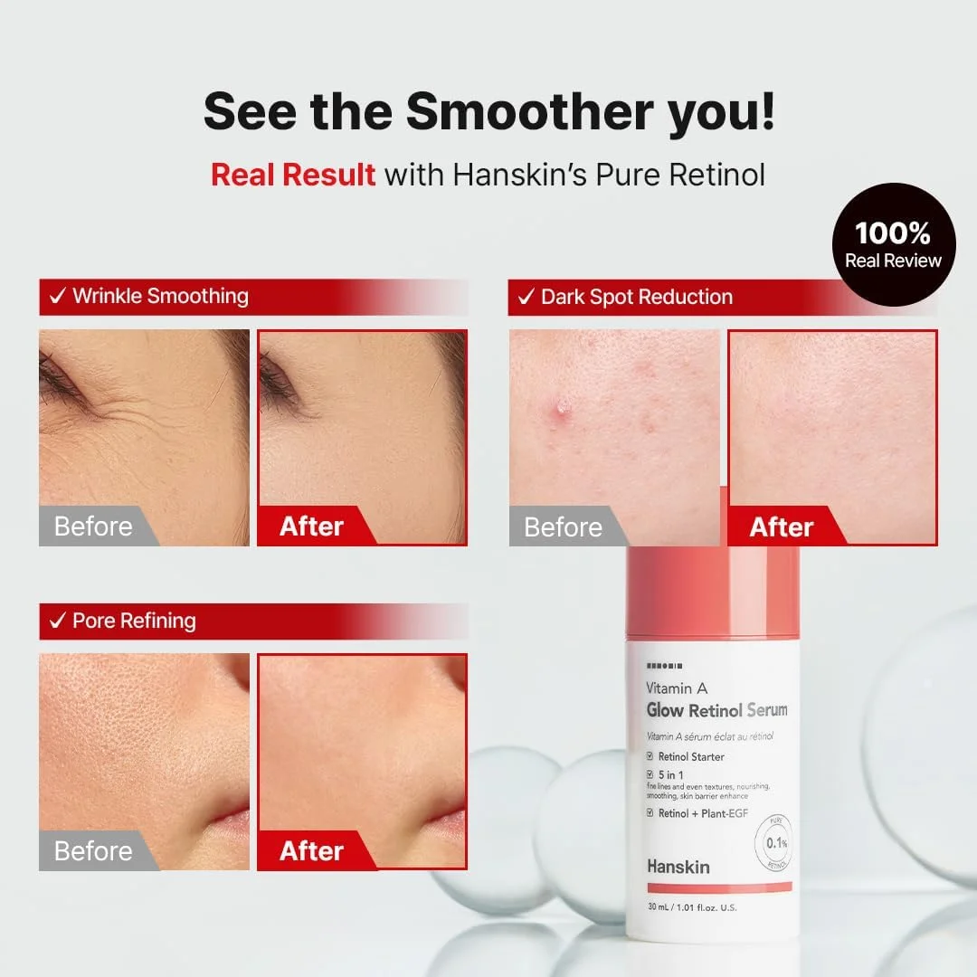 سرم صورت هانسکین حاوی 0.1% رتینول خالص برای مبتدیان، کاهش خطوط ریز و چروک، سرم مرطوب کننده ضد پیری، برای صاف کردن، استحکام بخشیدن، احیا و درخشش پوست، مراقبت از پوست کره ای، 30 میلی لیتر
