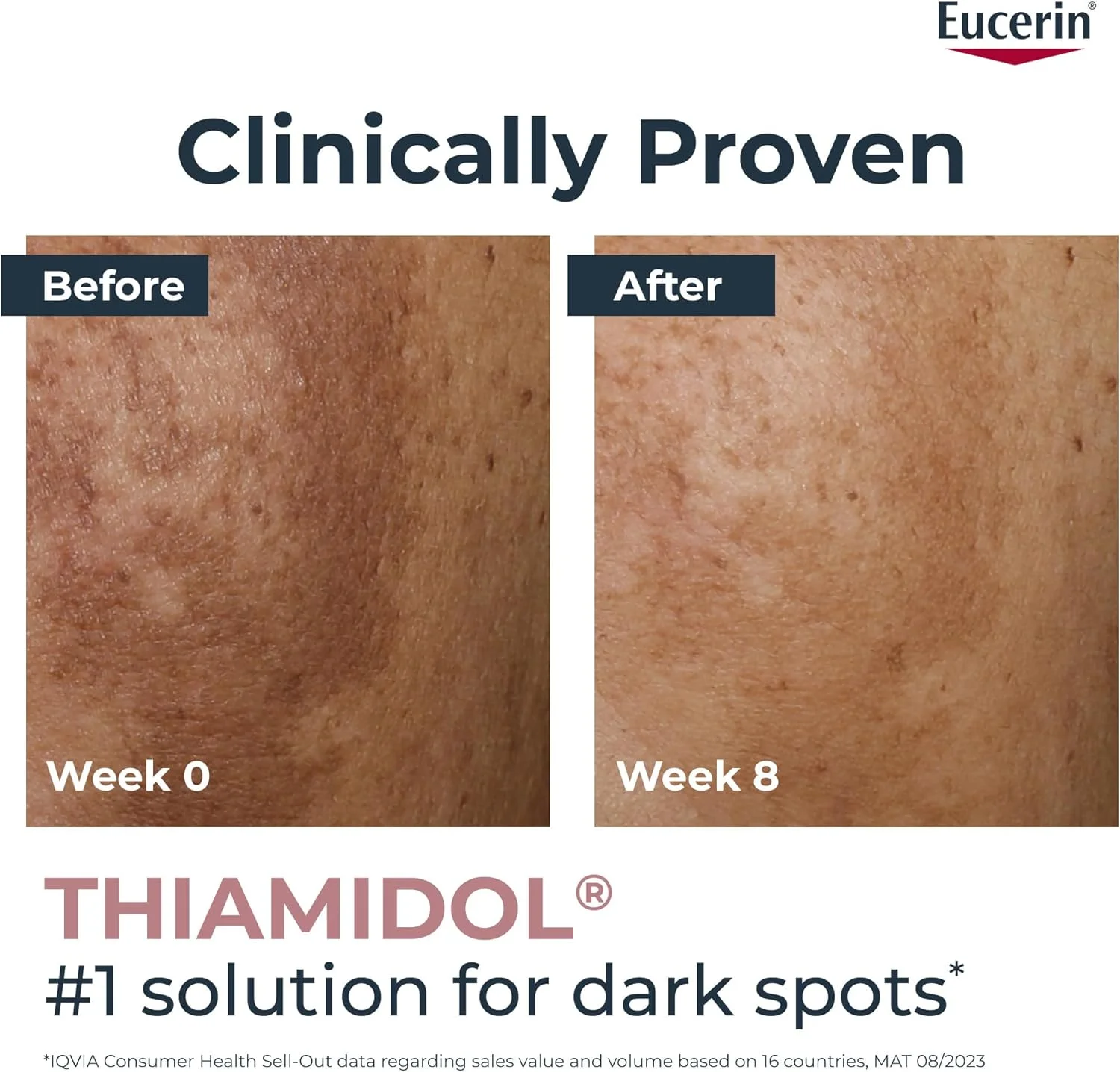 سرم صورت اصلاح کننده رنگدانه پوست اوسرین، حاوی تیامیدول و هیالورونیک اسید، کاهش دهنده لک های رنگدانه ای، درخشش قابل مشاهده پوست، مرطوب کننده برای انواع پوست، 30 میلی لیتر