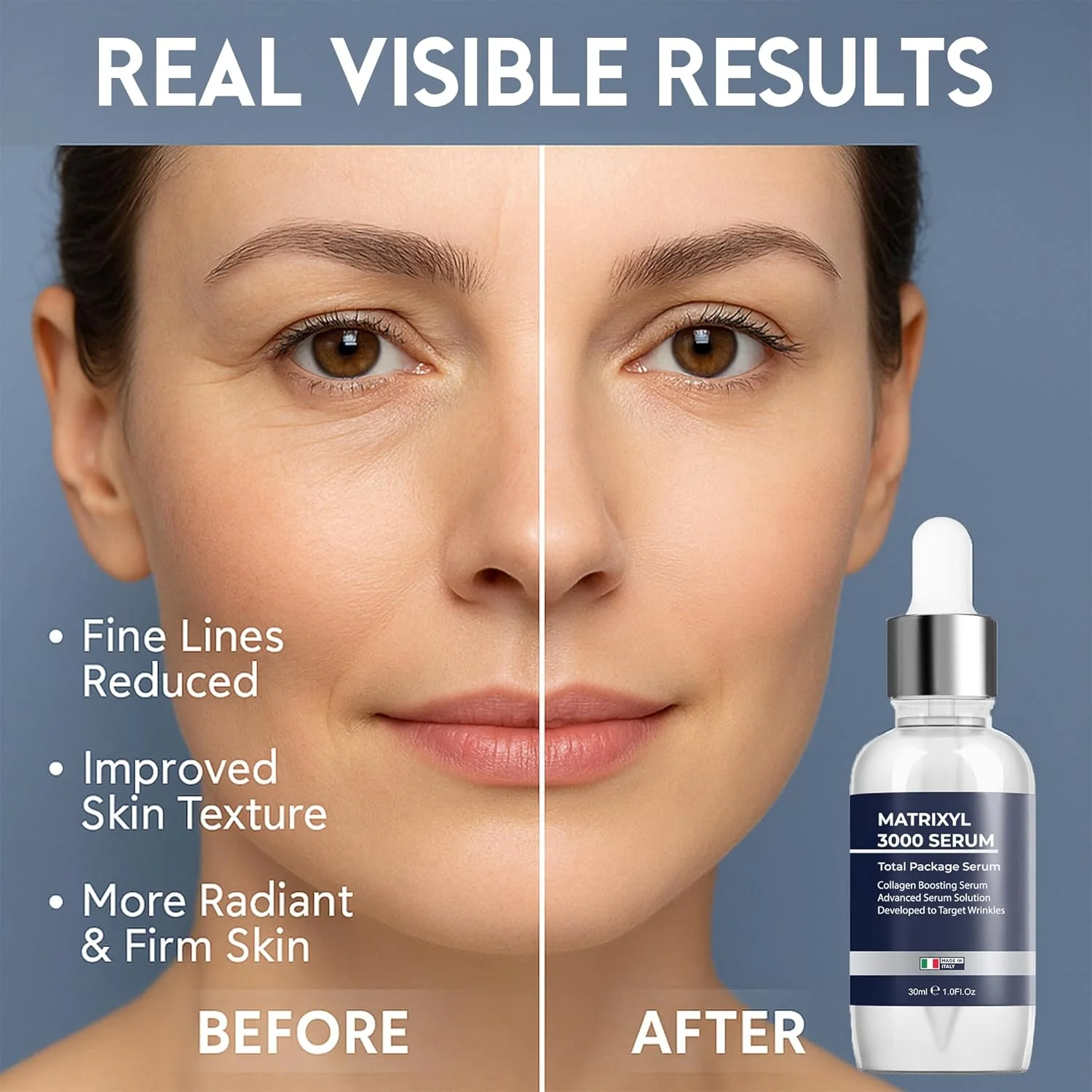 سرم ماتریکسیل 3000 با هیالورونیک اسید | سرم صورت ضد چروک، تقویت کننده کلاژن، ضد پیری و آبرسان | ترمیم کننده عمیق چروک، سفت کننده و استحکام بخش پوست برای خطوط ریز و چروک های پیشانی سرم ماتریکسیل 3000 با هیالورونیک اسید | سرم صورت ضد چروک، تقویت کننده کلاژن، ضد پیری و آبرسان | ترمیم کننده عمیق چروک، سفت کننده و استحکام بخش پوست برای خطوط ریز و چروک های پیشانی