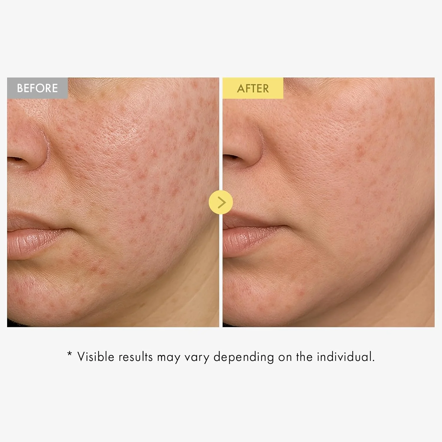 سرم پروپولیس و عسل توسوونگ حاوی هیالورونیک اسید، کوجیک اسید و نیاسینامید، مرطوب کننده سبک روزانه صورت، مراقبت از پوست کره ای، 33 میلی لیتر