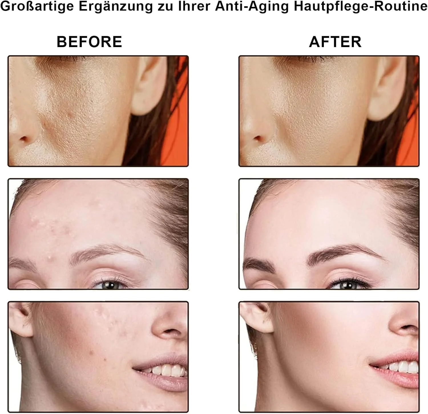 سرم صورت هیالورونیک اسید 2% + B5 برای آبرسانی عمیق، ضد چروک، کوچک کننده منافذ و کاهش لک های تیره، آبرسانی سبک وزن ضد پیری برای آقایان و بانوان، 30 میلی لیتر