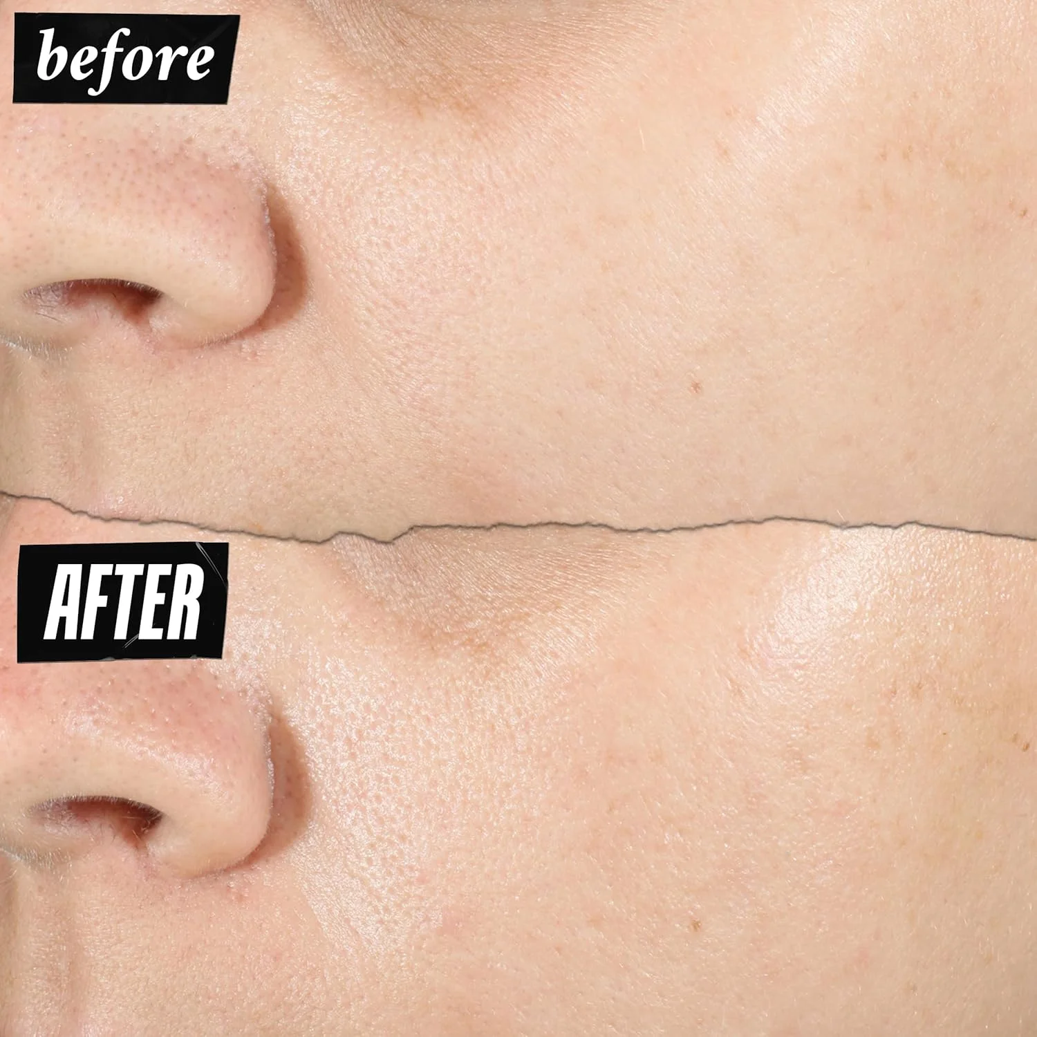 سرم هیالورونیک اسید خالص و قوی 1.5% کیلز، سرم صورت متمرکز برای پوست خشک، افزایش فوری آبرسانی، پرکننده پوست، مناسب انواع پوست، بدون عطر - 30 میلی لیتر