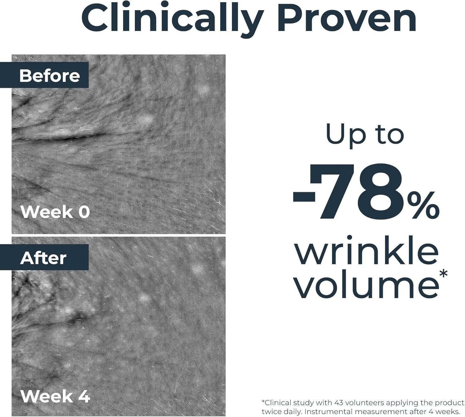 سرم ضد پیری هیالورون فیلر اوسرین اپی سلین، با فناوری ثبت شده Age Clock، به طور مشهود 10 نشانه پیری پوست را معکوس می کند، برای پوستی جوان تر، تست شده توسط متخصصین پوست، 30 میلی لیتر