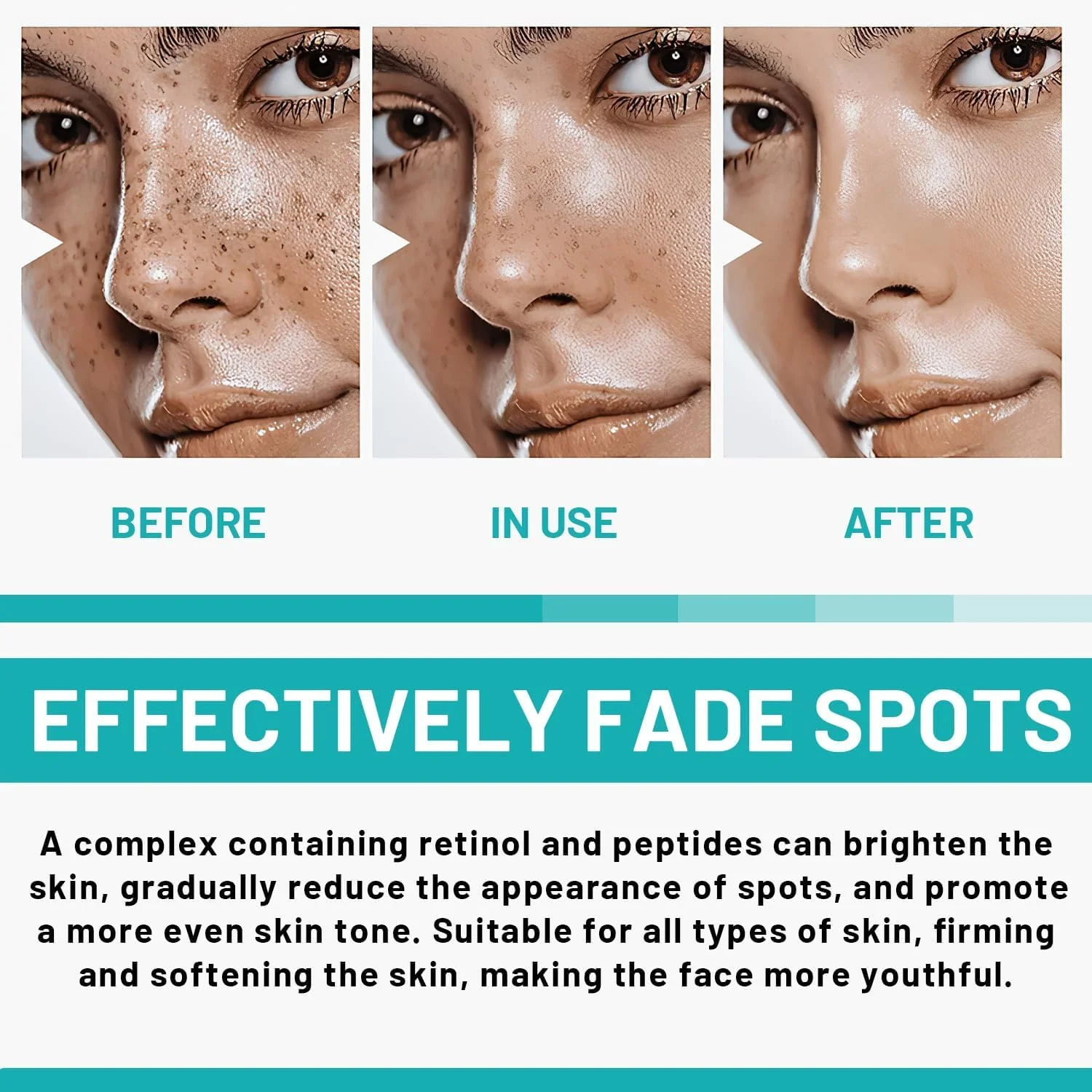 سرم رفع لکههای تیره صورت، سرم لکههای تیره با نیاسینامید رتینول برای لکههای ناشی از آفتاب، لکههای پیری، لکههای قهوهای، جای زخم آکنه و لکههای قهوهای ملاسما، فرمول پیشرفته برای زنان و مردان (30 گرم) - 2 عدد سرم رفع لکههای تیره صورت، سرم لکههای تیره با نیاسینامید رتینول برای لکههای ناشی از آفتاب، لکههای پیری، لکههای قهوهای، جای زخم آکنه و لکههای قهوهای ملاسما، فرمول پیشرفته برای زنان و مردان (30 گرم) - 2 عدد