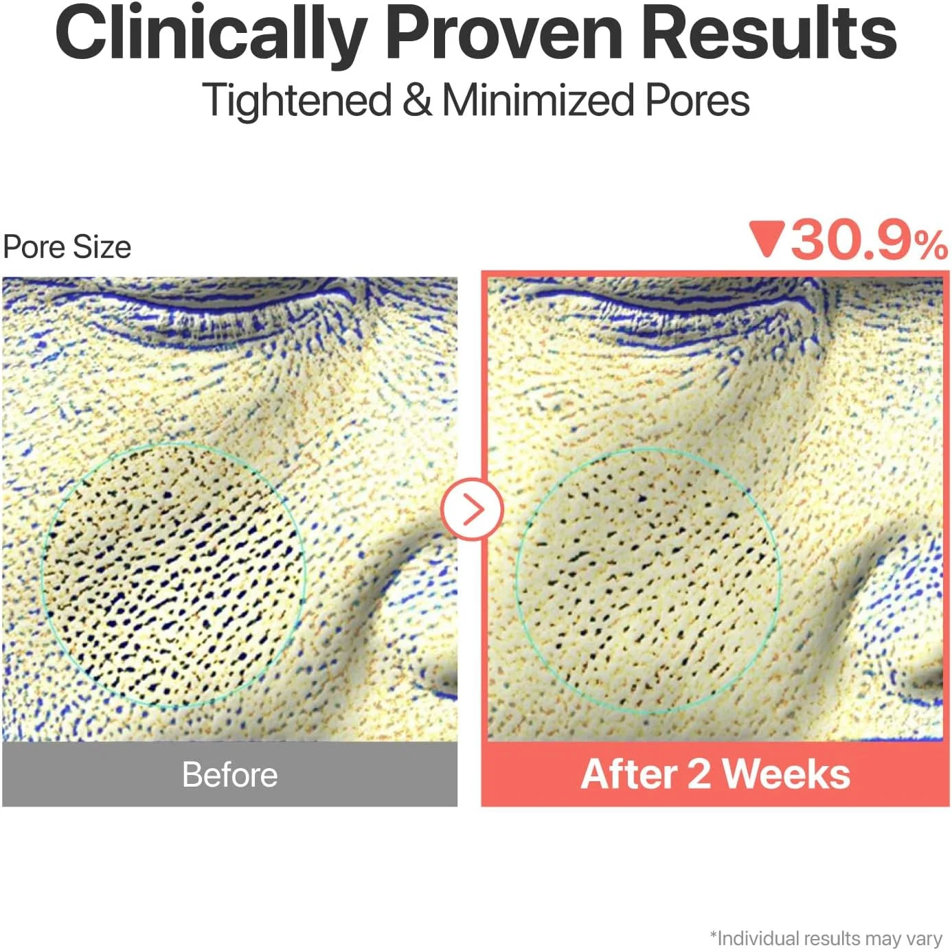 سرم شماره 3 نامبروزین | سرم نرم کننده پوست | مراقبت از منافذ، پوست ناهموار و شیشه ای | بیفیدا، گالاکتومایسس، نیاسینامید، آدنوزین، پانتنول | 50 میلی لیتر سرم شماره 3 نامبروزین | سرم نرم کننده پوست | مراقبت از منافذ، پوست ناهموار و شیشه ای | بیفیدا، گالاکتومایسس، نیاسینامید، آدنوزین، پانتنول | 50 میلی لیتر