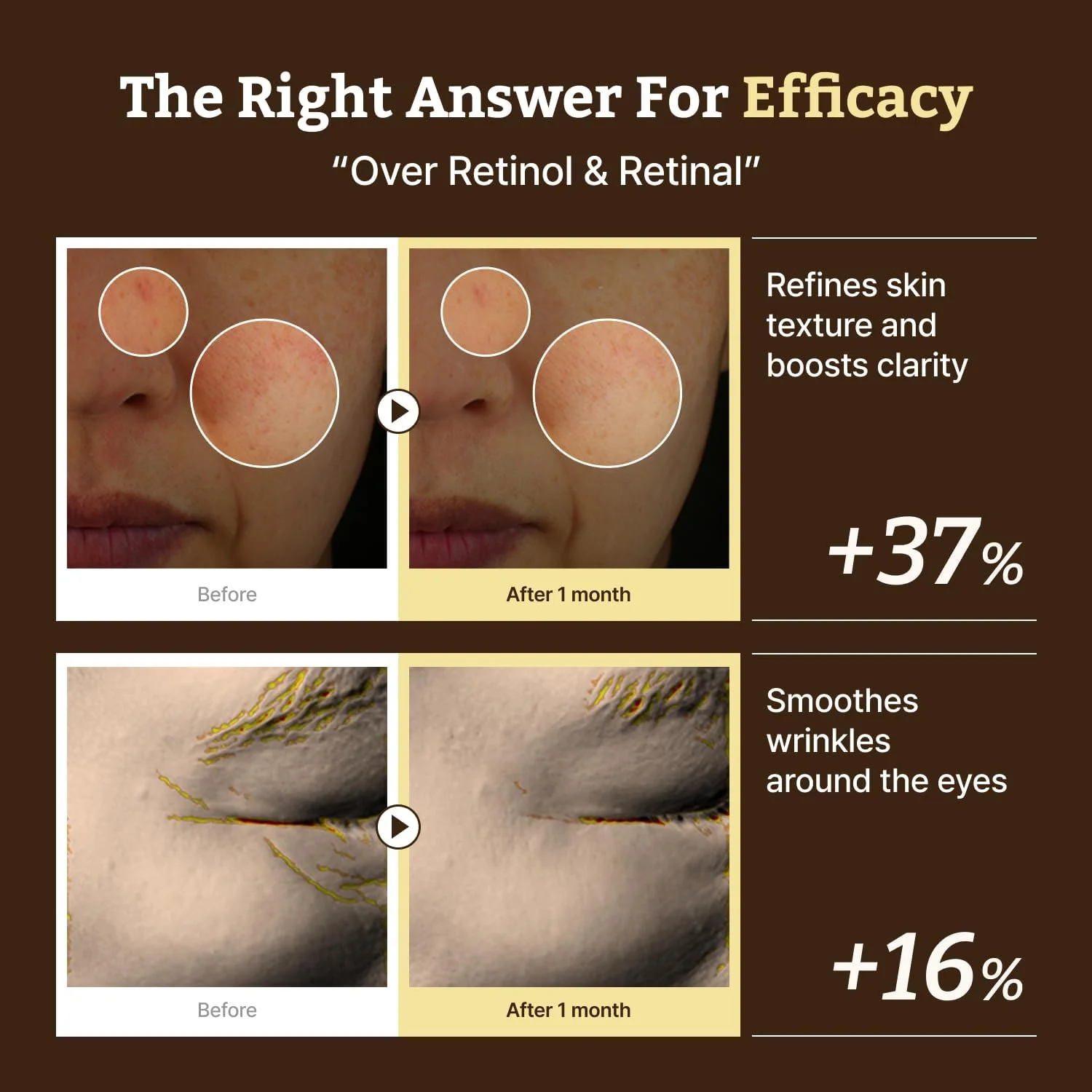 سرم پیشرفته رتینو-ملا – سرم رتینول HPR برای صورت – ضد پیری، کوچک کننده منافذ، مراقبت از پوست کره ای نسل جدید – ملایم و مناسب برای مبتدیان – حاوی نیاسینامید 10% و TXA 4% – 30 میلی لیتر سرم پیشرفته رتینو-ملا – سرم رتینول HPR برای صورت – ضد پیری، کوچک کننده منافذ، مراقبت از پوست کره ای نسل جدید – ملایم و مناسب برای مبتدیان – حاوی نیاسینامید 10% و TXA 4% – 30 میلی لیتر