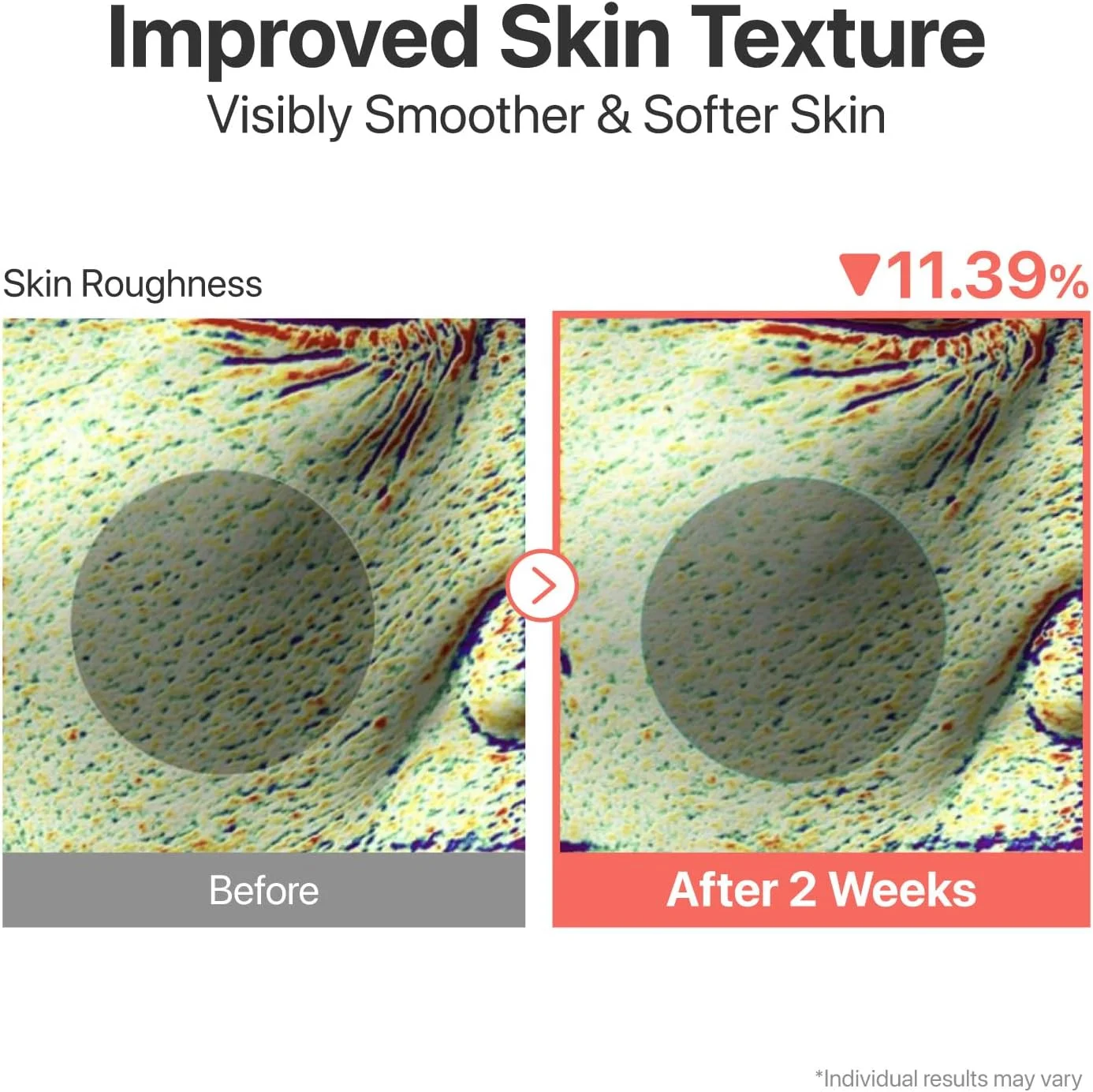 سرم شماره 3 نامبروزین | سرم نرم کننده پوست | مراقبت از منافذ، پوست ناهموار و شیشه ای | بیفیدا، گالاکتومایسس، نیاسینامید، آدنوزین، پانتنول | 50 میلی لیتر سرم شماره 3 نامبروزین | سرم نرم کننده پوست | مراقبت از منافذ، پوست ناهموار و شیشه ای | بیفیدا، گالاکتومایسس، نیاسینامید، آدنوزین، پانتنول | 50 میلی لیتر