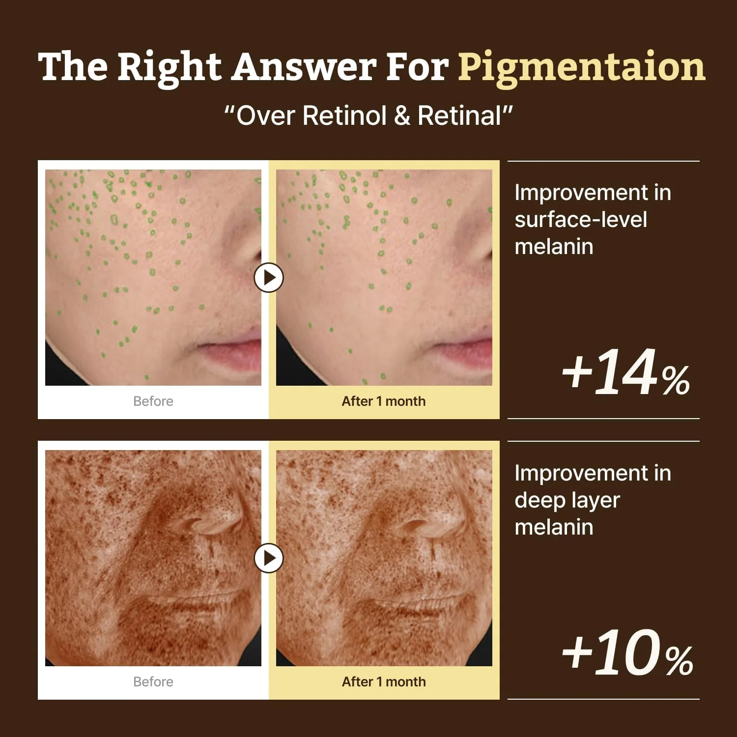 سرم پیشرفته رتینو-ملا – سرم رتینول HPR برای صورت – ضد پیری، کوچک کننده منافذ، مراقبت از پوست کره ای نسل جدید – ملایم و مناسب برای مبتدیان – حاوی نیاسینامید 10% و TXA 4% – 30 میلی لیتر سرم پیشرفته رتینو-ملا – سرم رتینول HPR برای صورت – ضد پیری، کوچک کننده منافذ، مراقبت از پوست کره ای نسل جدید – ملایم و مناسب برای مبتدیان – حاوی نیاسینامید 10% و TXA 4% – 30 میلی لیتر