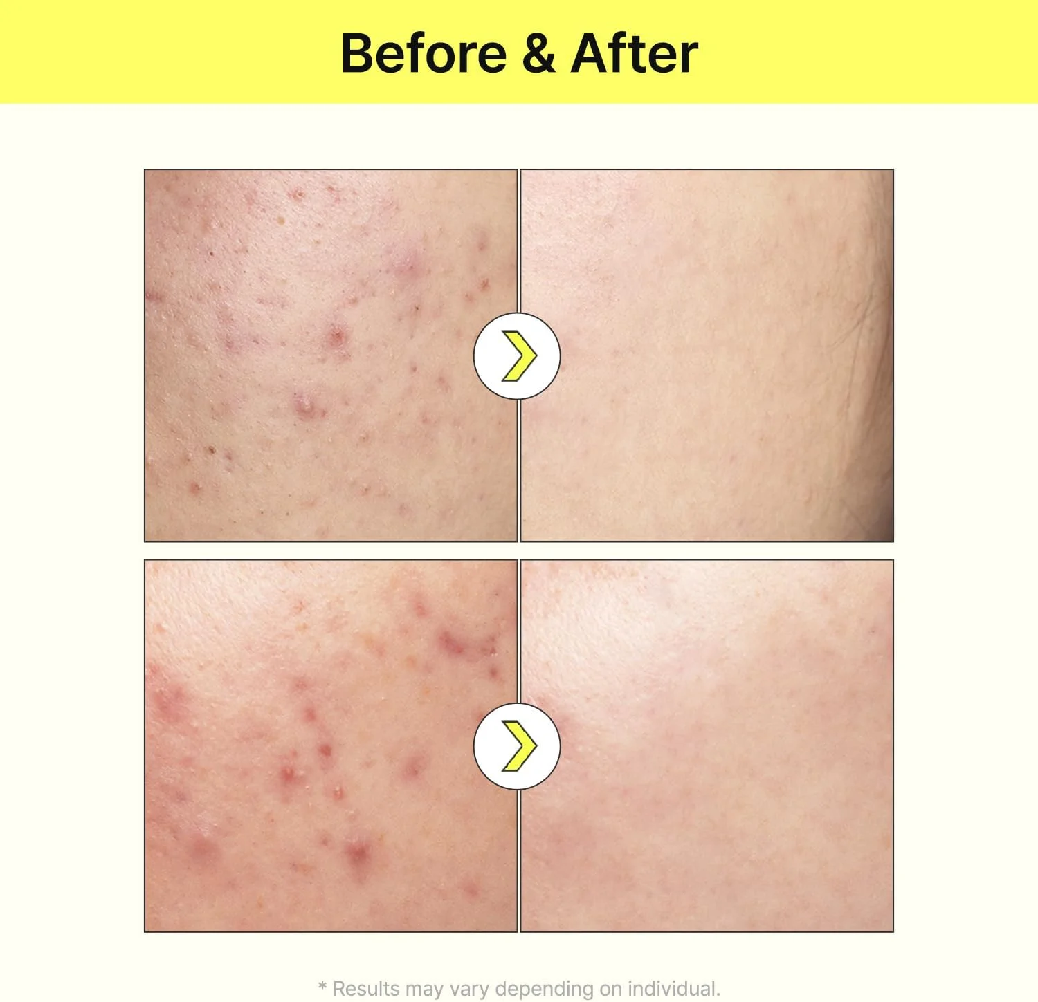 سرم نیاسینامید TIA'M Vita B3 Source، سرم نیاسینامید 10% (ویتامین B3)، سرم آربوتین 2%، لکههای پوستی، هایپرپیگمنتیشن، لکه تیره، 40 میلی لیتر سرم نیاسینامید TIA'M Vita B3 Source، سرم نیاسینامید 10% (ویتامین B3)، سرم آربوتین 2%، لکههای پوستی، هایپرپیگمنتیشن، لکه تیره، 40 میلی لیتر