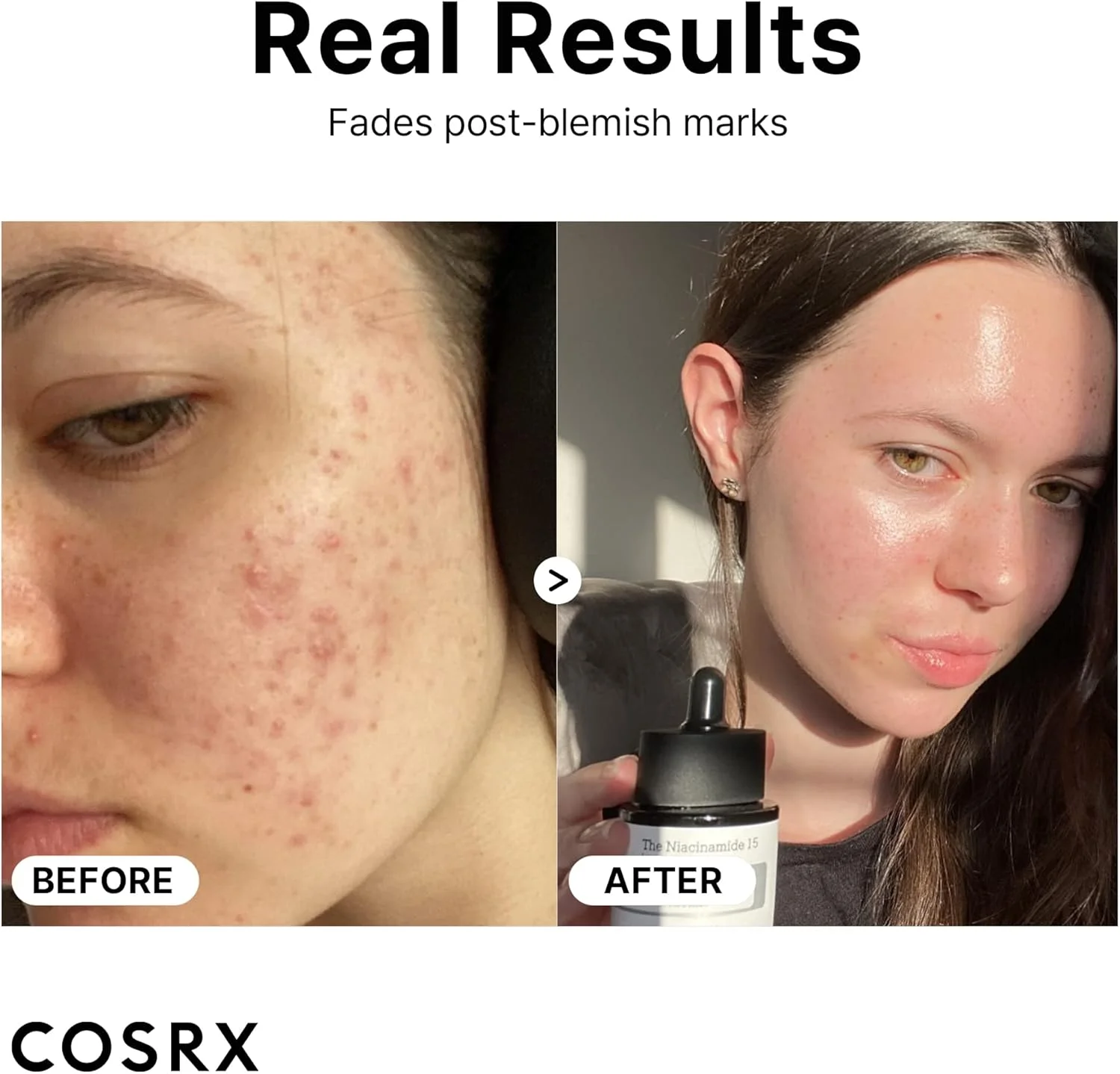 سرم صورت نیاسینامید 15% COSRX، کوچک کننده منافذ و کنترل کننده سبوم، درمان لک برای تغییر رنگ پوست، نقاط تیره و منافذ باز، ضد پیری، 20 میلی لیتر، بدون تست حیوانی