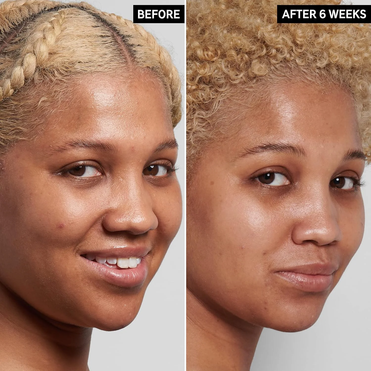 سرم نیاسینامید 10% اینکی لیست، سرم سبک کنترل چربی پوست کمک به کاهش لک و قرمزی پوست، حاوی 1% هیالورونیک اسید آبرسان 30 میلی لیتر