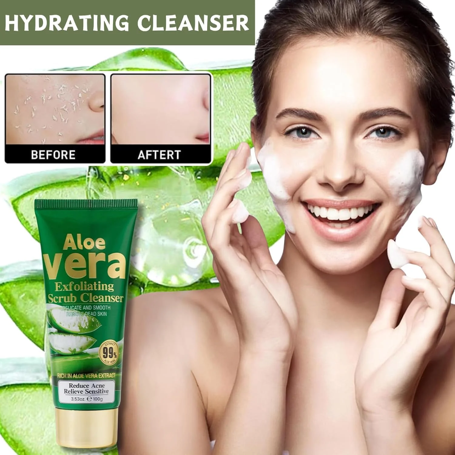 ژل شستشوی صورت آلوئه ورا، پاک کننده و لایه بردار عمیق، تسکین دهنده و پاک کننده پوست صورت، مناسب برای پوست های مستعد جوش، پوست چرب، جوش های سرسیاه، لک های تیره، آکنه و پاکسازی منافذ