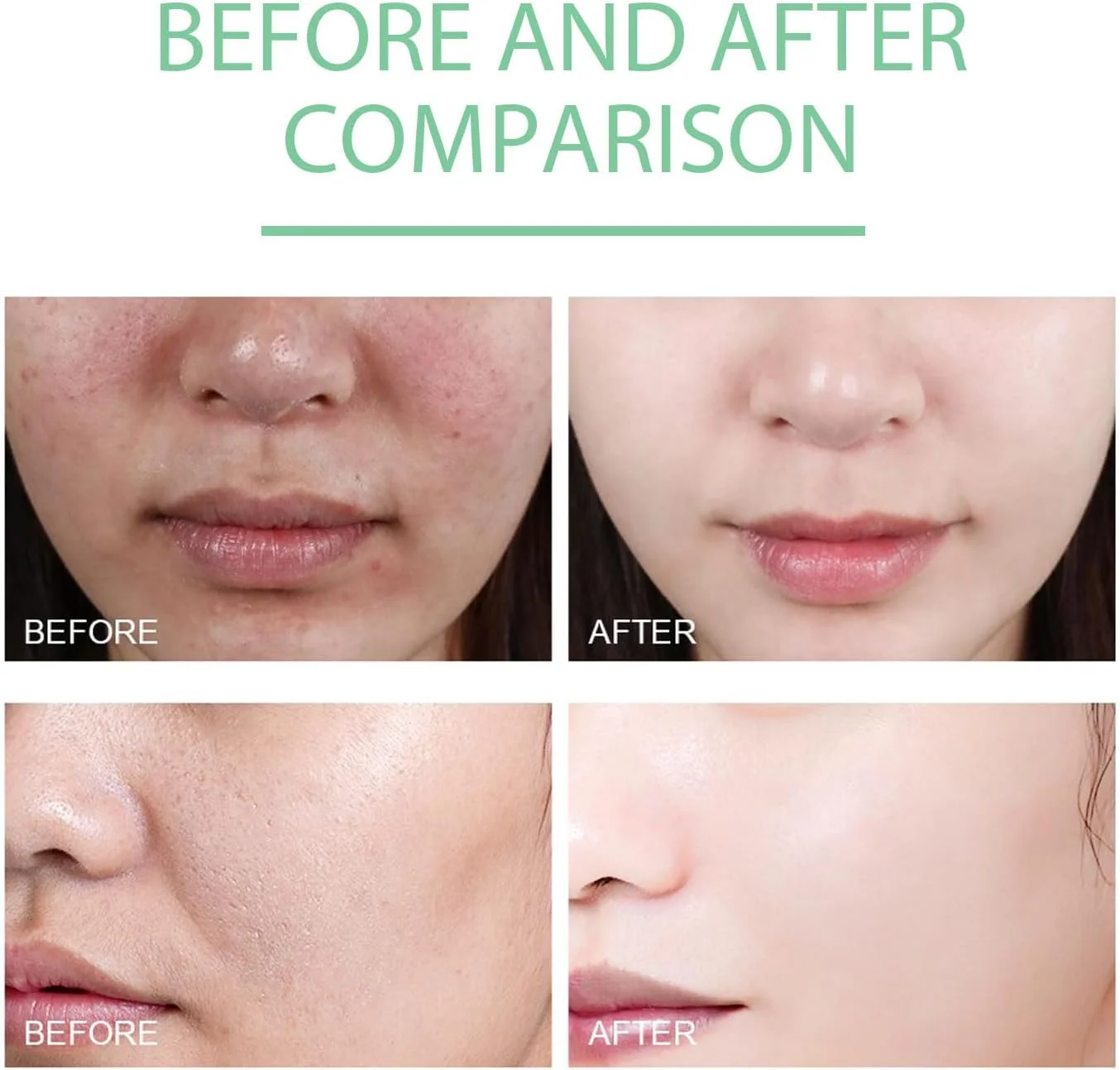 ژل لایه بردار - ژل لایه بردار روشن کننده گیاهی غنی شده با عصاره کلرلا ولگاریس و کلاژن هیدرولیز شده، پاک کننده عمیق برای روشن کردن، صاف کردن و پاکسازی منافذ پوست برای داشتن پوستی درخشان و بی عیب و نقص