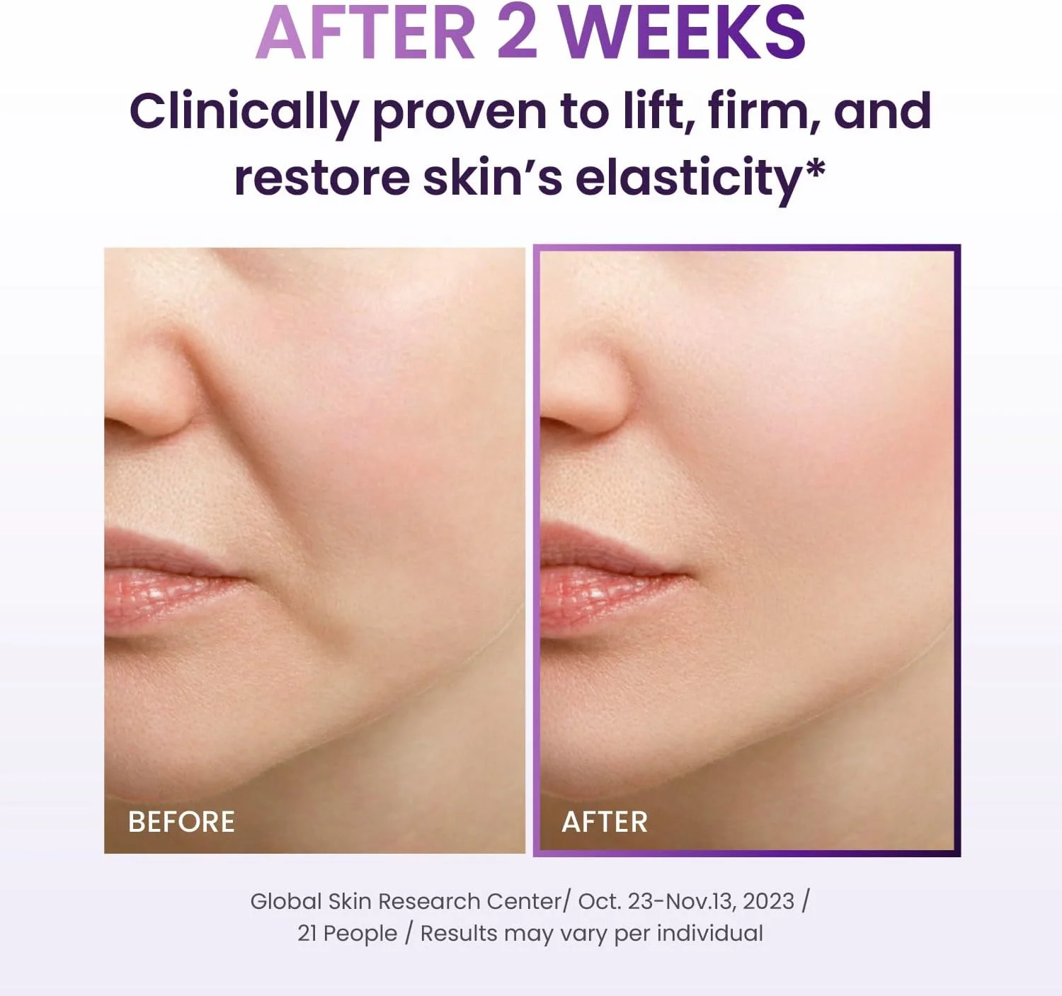 کرم لیفتینگ سه بعدی BIOHEAL BOH Probioderm حجم 50 میلی لیتر | کرم شب صورت ضد پیری پیشرفته کره ای حاوی پروبیوتیک، کمپلکس 17 پپتیدی و Probioderm ثبت اختراع شده برای چروک صورت و گردن کرم لیفتینگ سه بعدی BIOHEAL BOH Probioderm حجم 50 میلی لیتر | کرم شب صورت ضد پیری پیشرفته کره ای حاوی پروبیوتیک، کمپلکس 17 پپتیدی و Probioderm ثبت اختراع شده برای چروک صورت و گردن