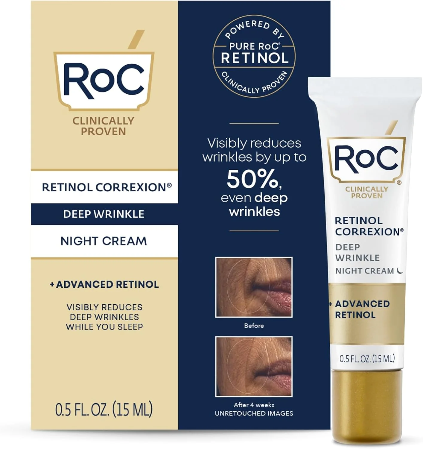 کرم شب ضد چروک عمقی RoC Retinol Correxion، مرطوب کننده روزانه صورت با شی باتر، گلیکولیک اسید و اسکوالان، درمان مراقبت از پوست، مینی 0.5 اونس (بسته بندی ممکن است متفاوت باشد)