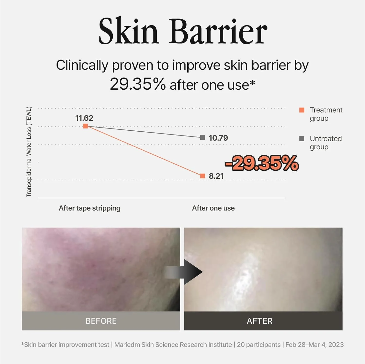 اسپری آبرسان صورت | اسپری مه صورت | 340 میلی لیتر