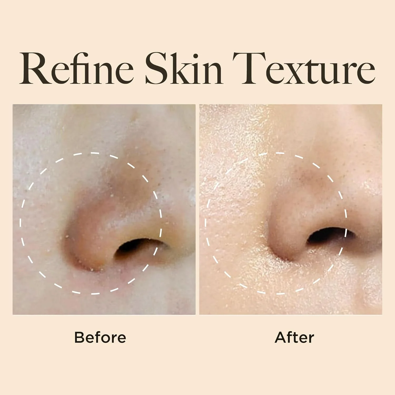 الیشاکوی، کومبوچا گیول-بیوم - تونر میست صورت کره‌ای، اسپری آبرسان - مرطوب کننده و صاف کننده پوست برای میست صورت، اسپری صورت، مراقبت از پوست - فرمول وگان (100 میلی لیتر/ 3.38 اونس مایع)