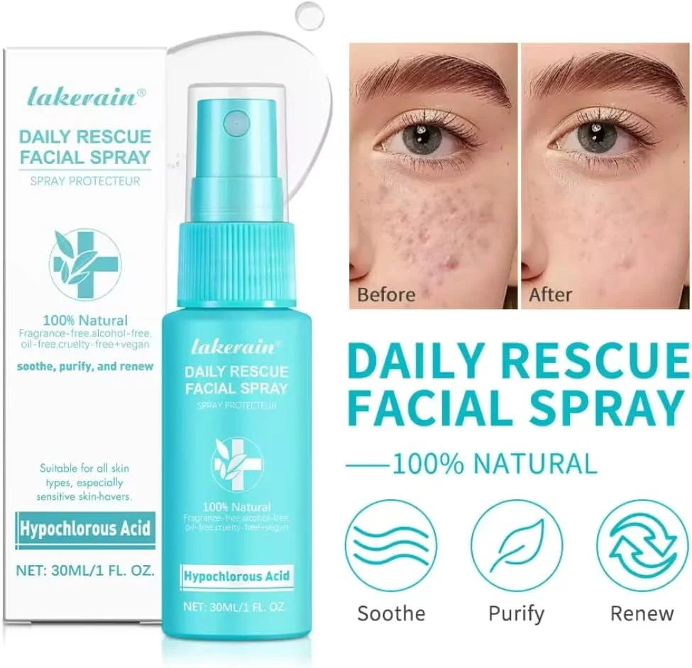 اسپری صورت روزانه NIKITA.VIVI مناسب پوست حساس 30 میلی لیتر، اسپری نجات دهنده صورت حاوی اسید هیپوکلروس، کمک به کاهش قرمزی و جوش، پاک کننده، احیا کننده و تسکین دهنده و متعادل کننده PH پوست صورت