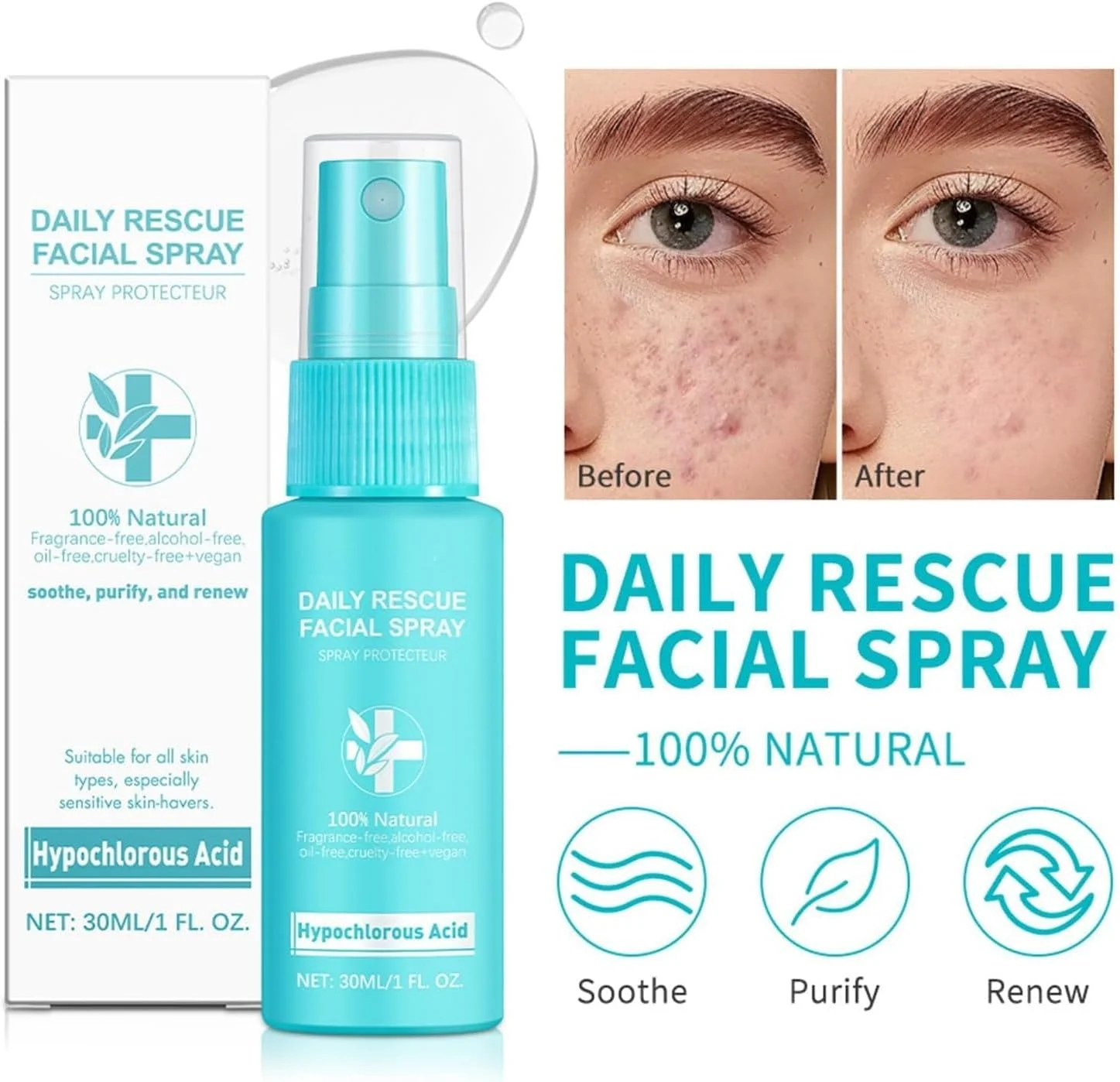 اسپری اسید هیپوکلروس FUIN برای صورت و پوست، ایمن برای استفاده در پوست های مستعد آکنه، اسپری تسکین دهنده صورت برای پوست های حساس، مه آبرسان صورت، تونر تجدید کننده پوست (3 عدد)