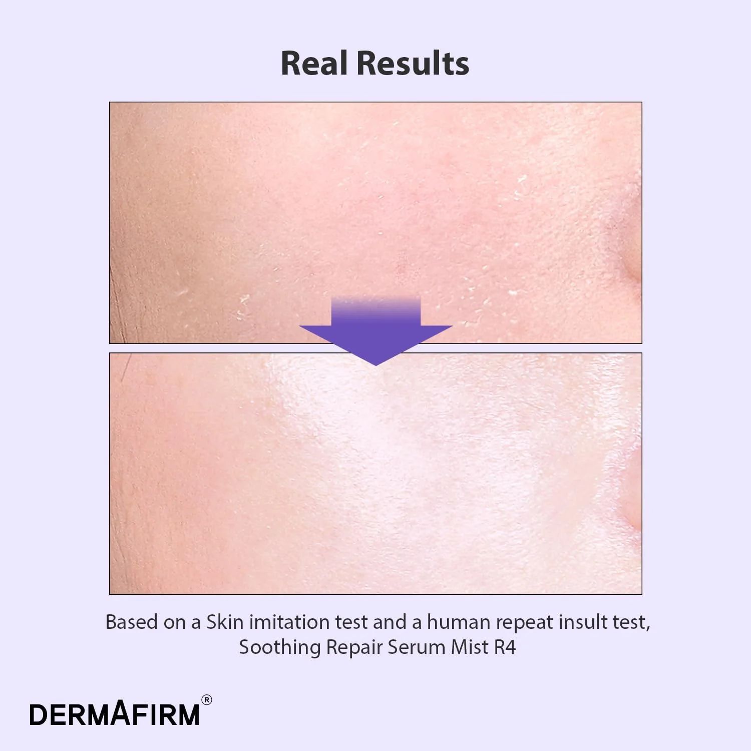 سرم صورت التیام بخش و ترمیم کننده DERMAFIRM R4 | اسپری آبرسان صورت برای لک های تیره حاوی اکالیپتوس، پپتید و کلاژن | ملایم برای انواع پوست بدون تست حیوانی و پارابن 100 میلی لیتر