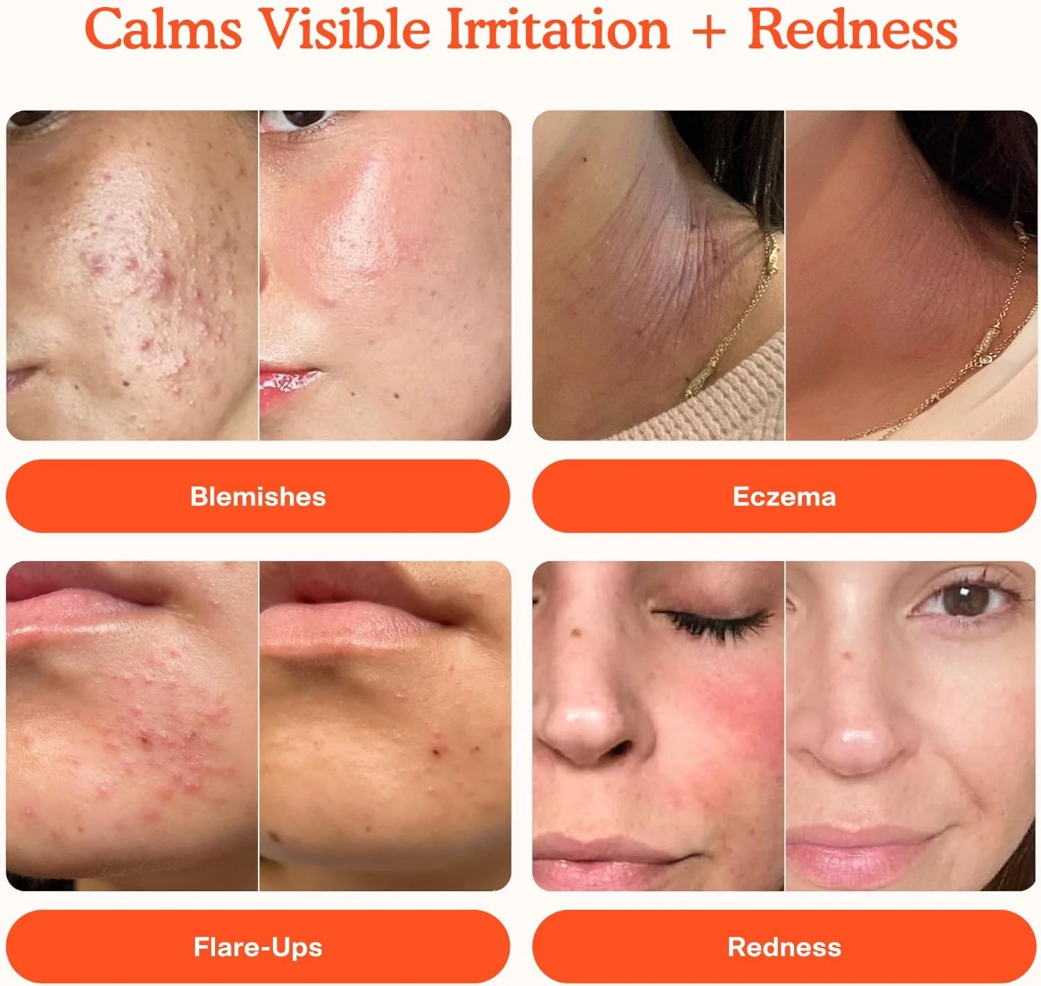 اسپری صورت نجات روزانه مینی SOS Tower 28 Beauty